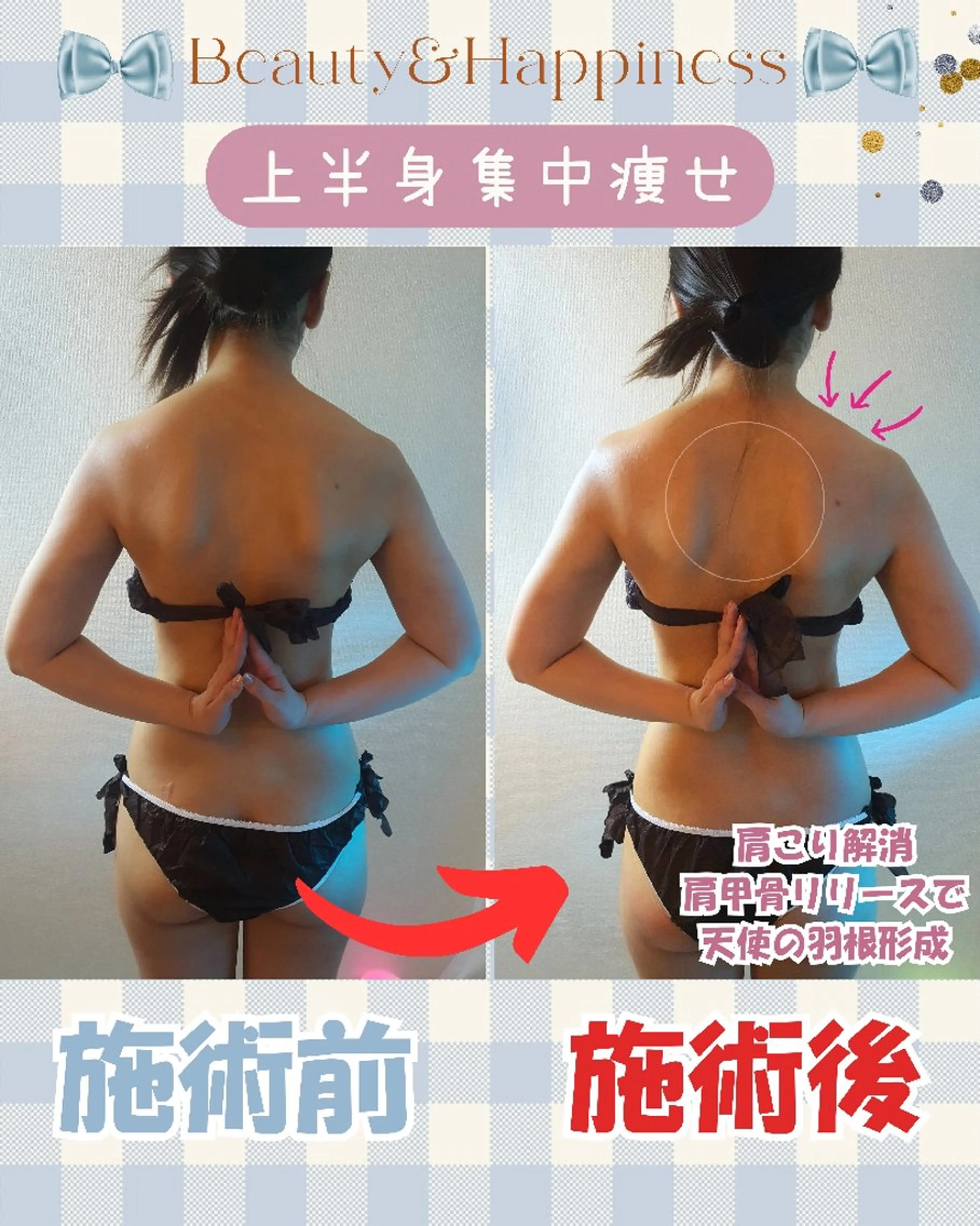 痩身ハーブピーリング 筋膜リリース☆B&Hのエステ・リラクイメージ