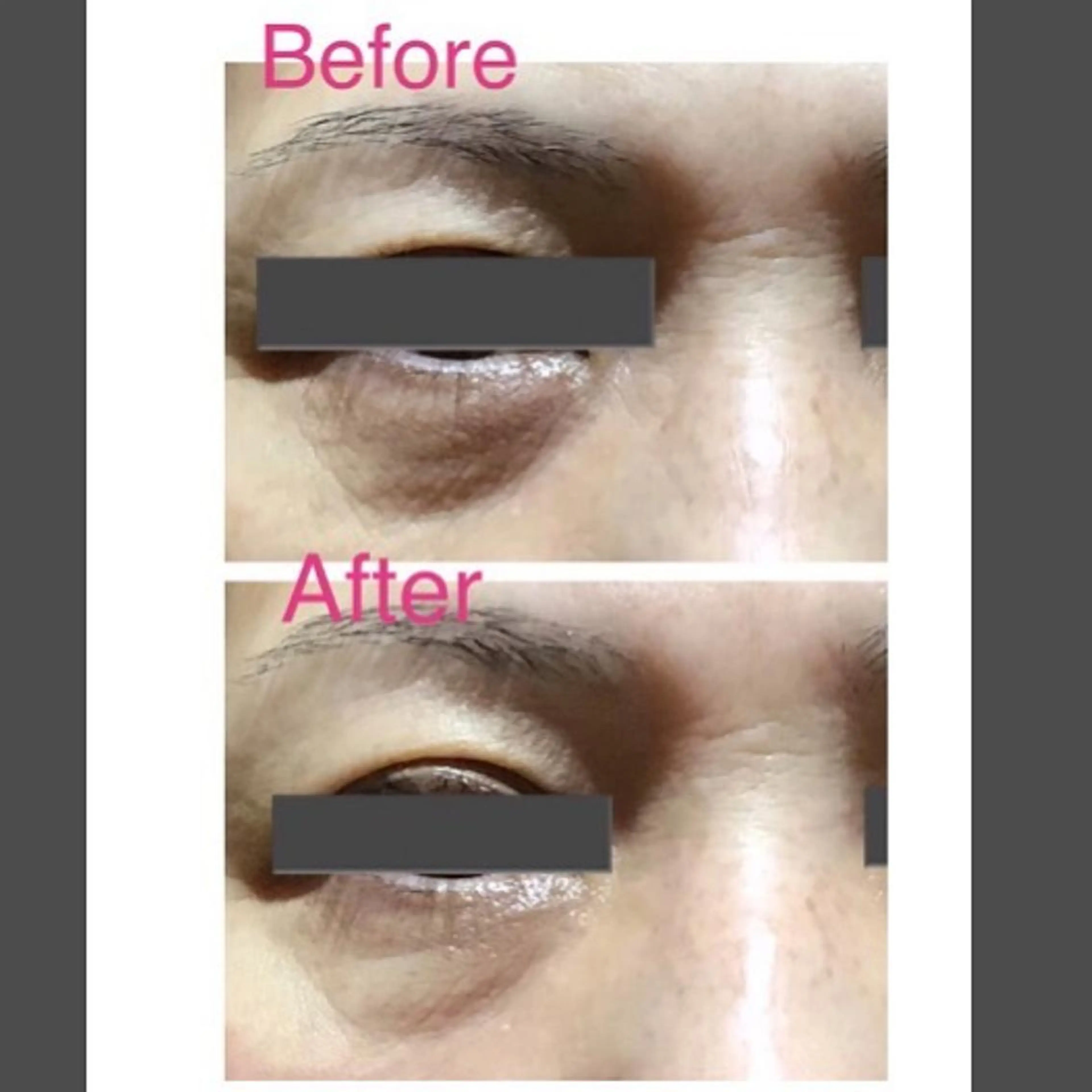 エステ リラク エヴァーグレース 河原町店のエステ・リラクイメージ