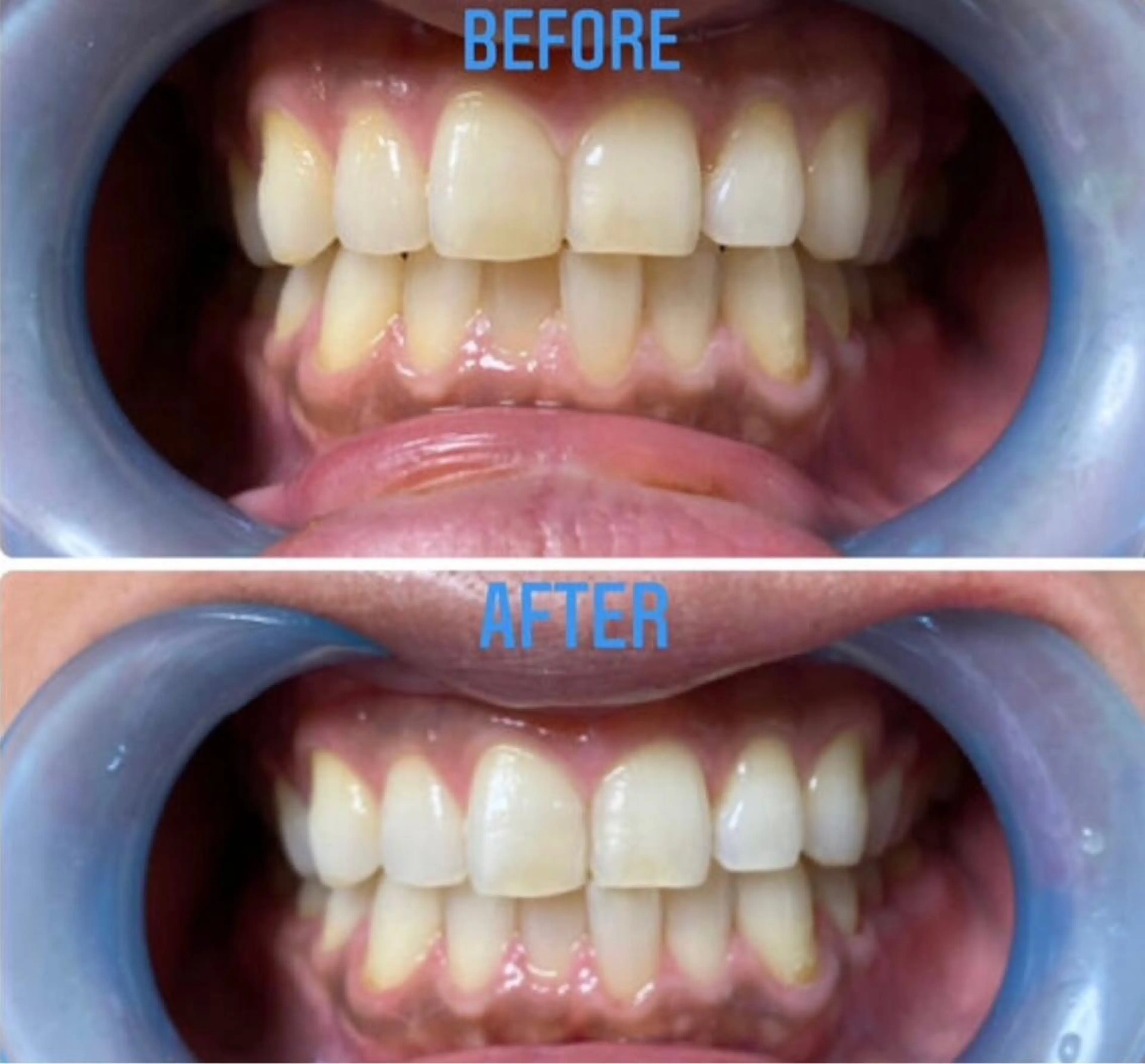 Venus Beauty銀座のマツエク・マツパデザイン