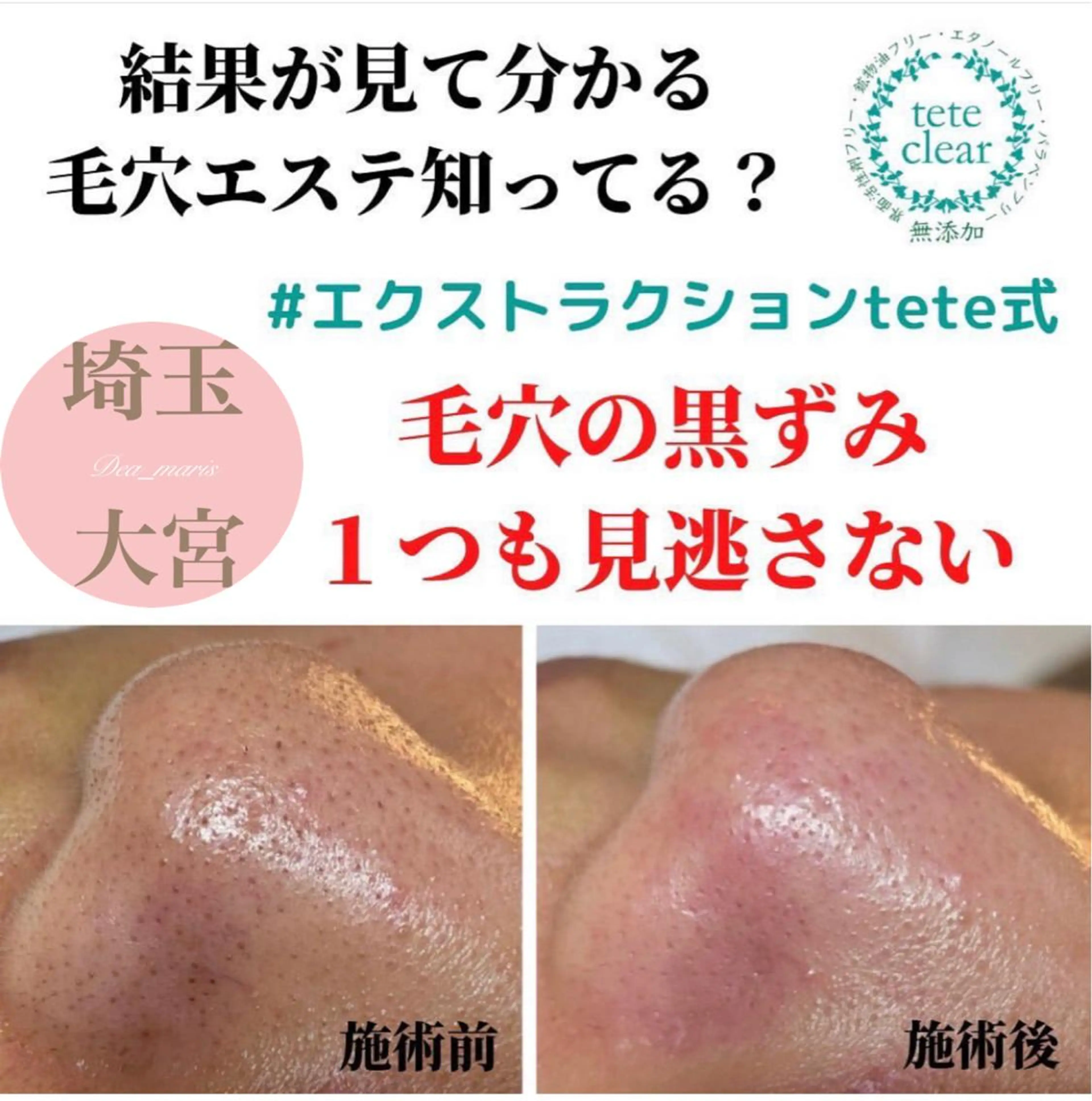 private salon  Dea_maris シュガーリング＆パーソナルボディケア所属・シミ改善・韓国肌管理 ボディメイク痩身のその他イメージ