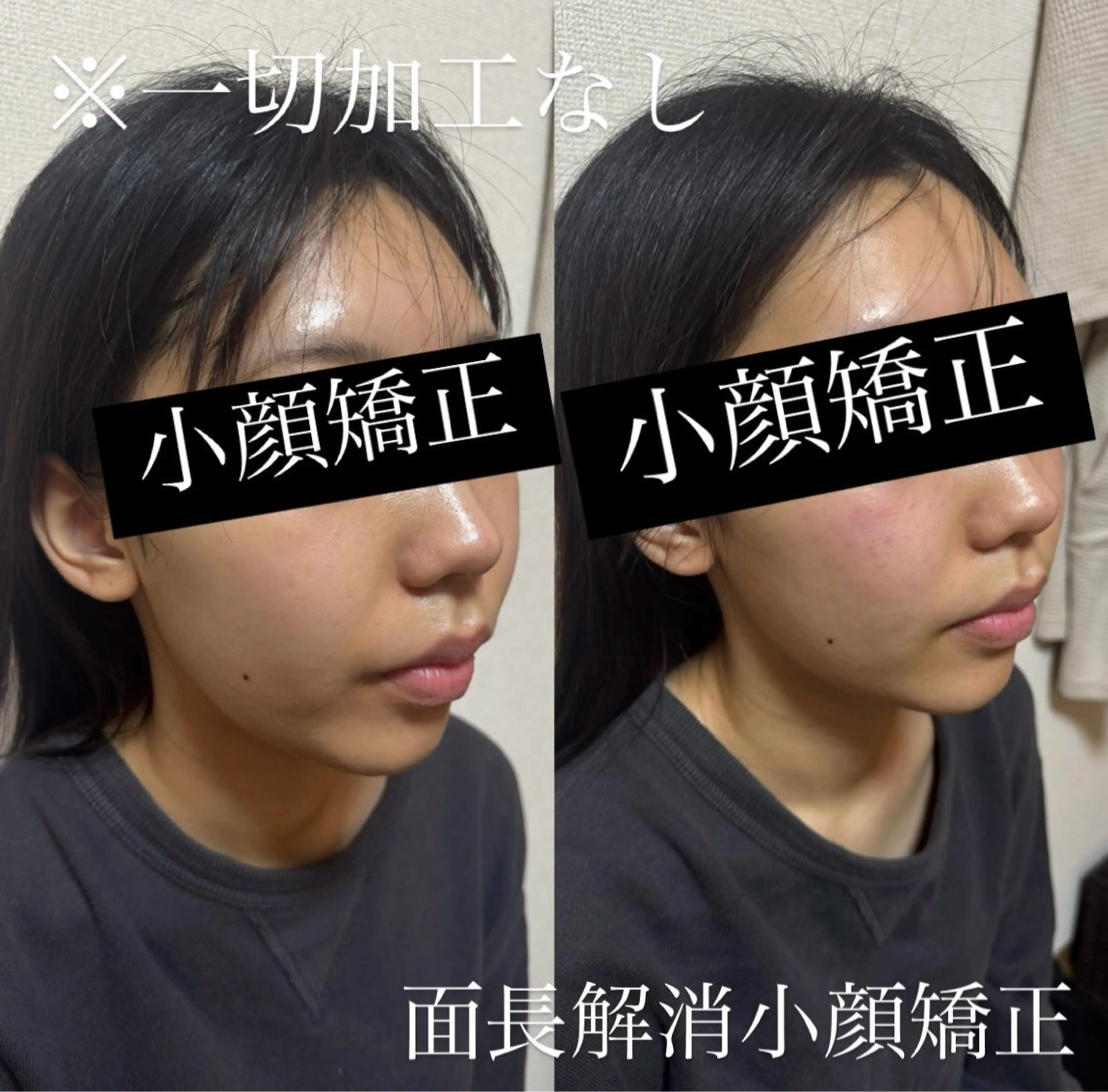 Amaranth所属・Lupinus 小顔矯正のエステ・リラクイメージ