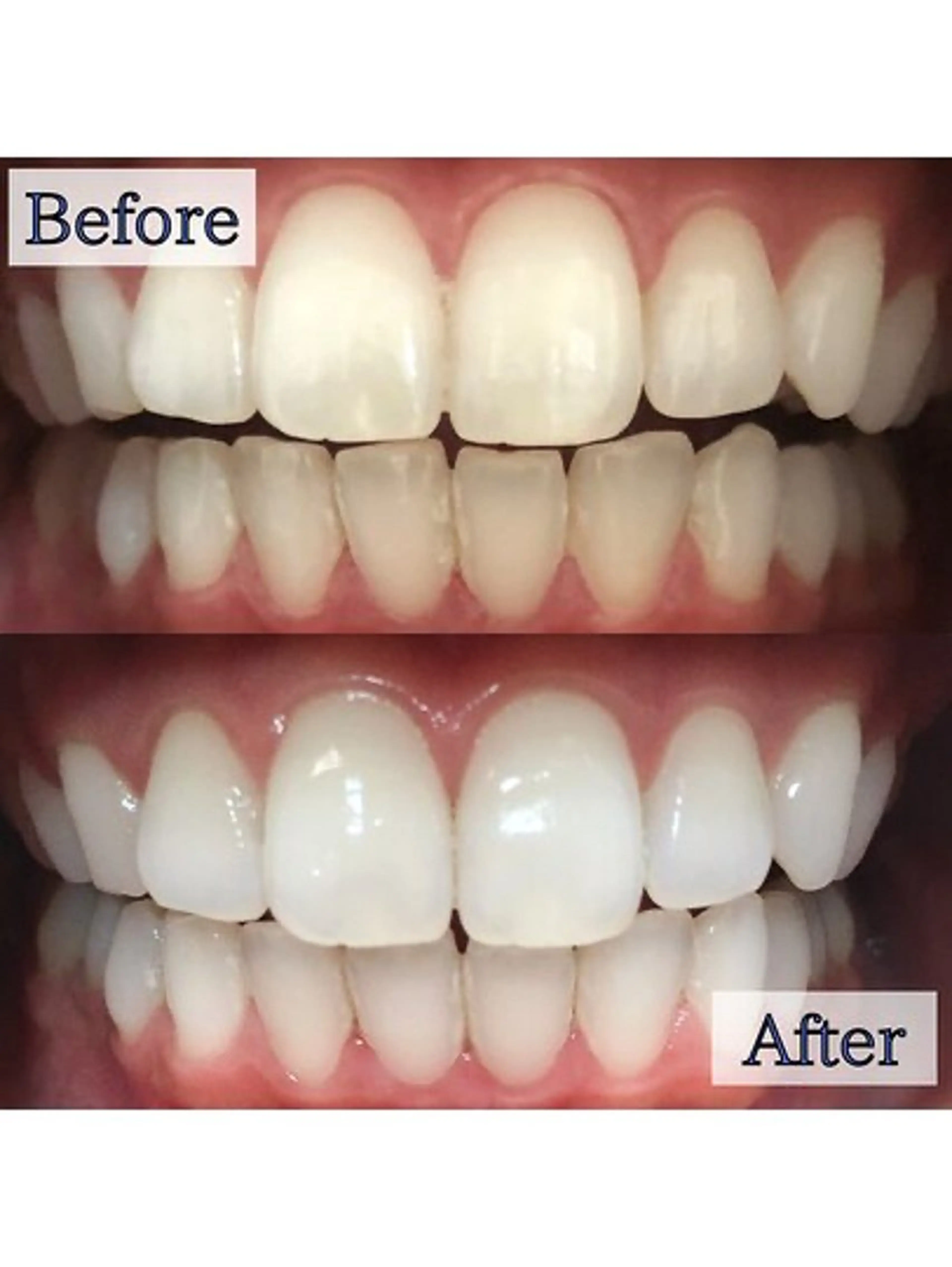 エステ リラク LBSホワイトニング上野店所属・LBSホワイトニング 🌐 上野店公式のエステ・リラクイメージ