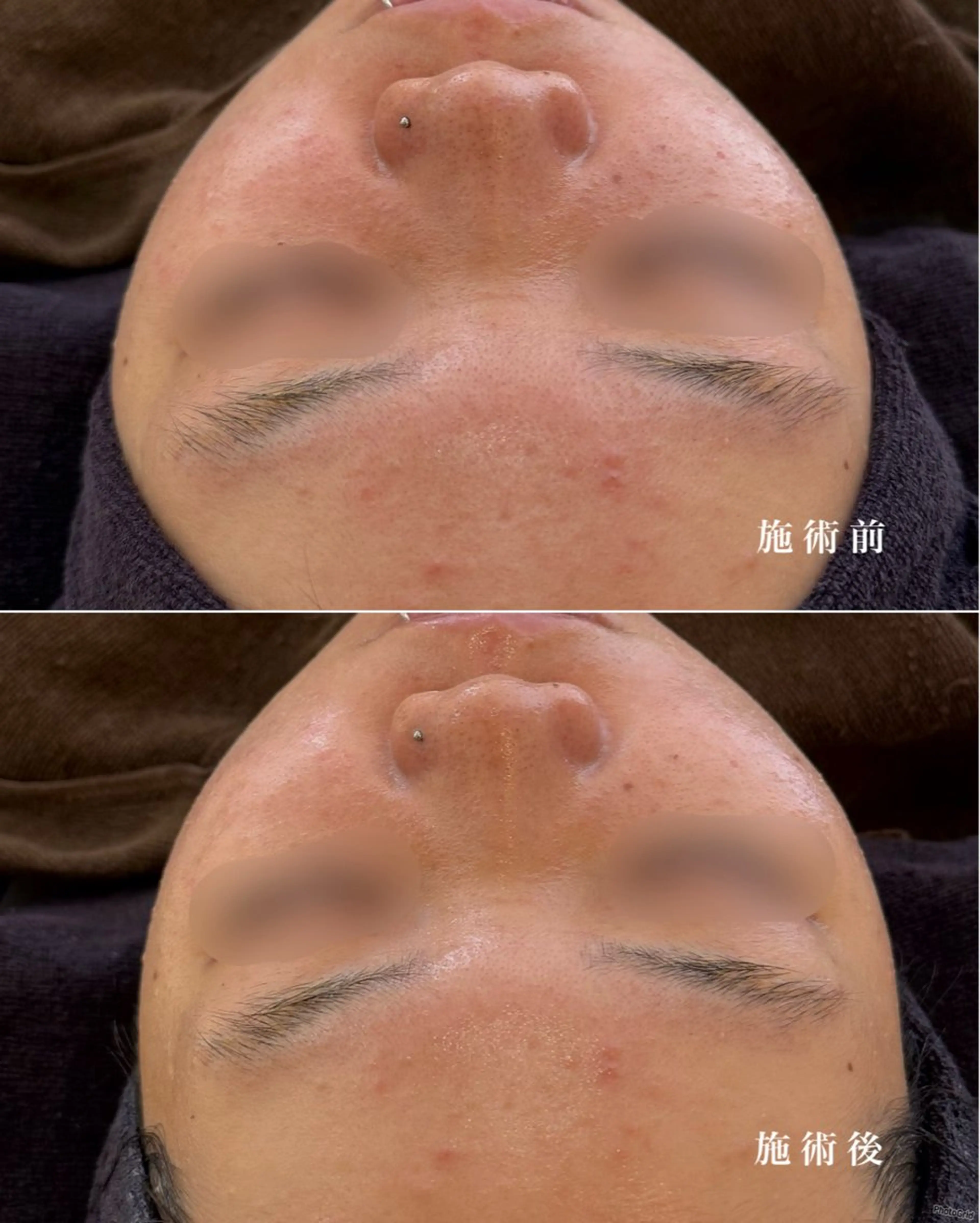 エステ écla【中崎町】 yukikoのエステ・リラクイメージ