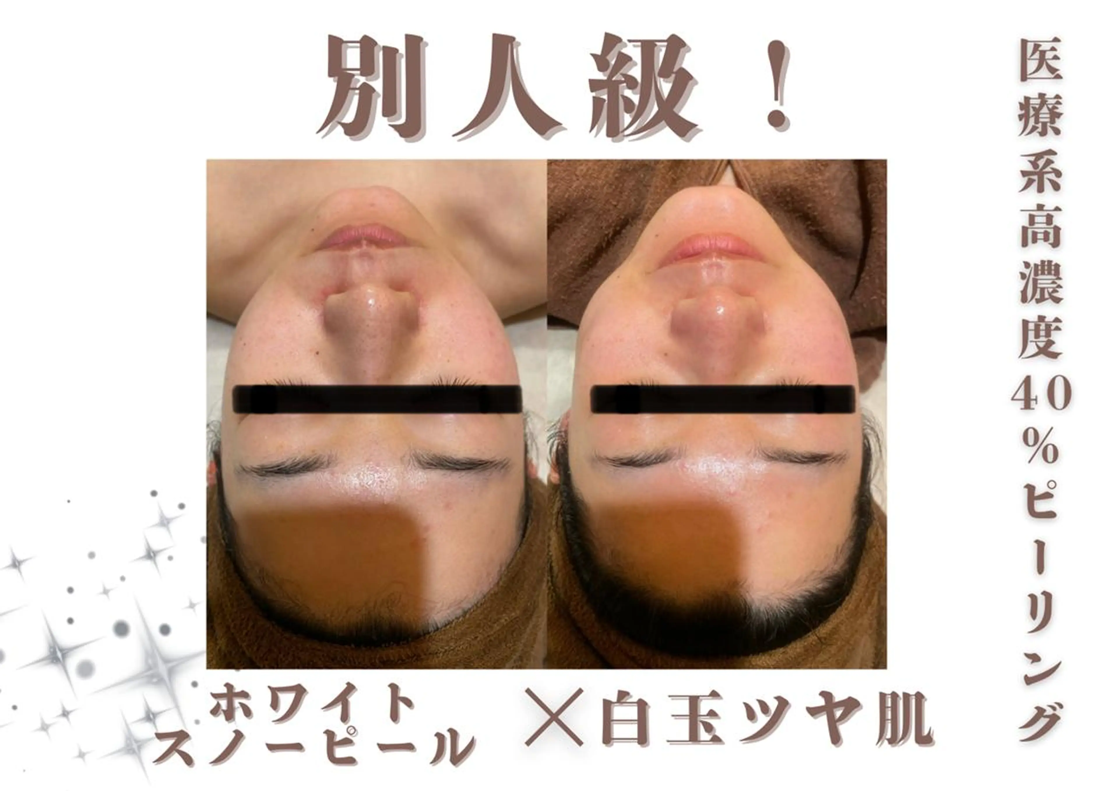 脱毛 創業40周年✨美肌サ ロンRAYVIS銀座のエステ・リラクイメージ