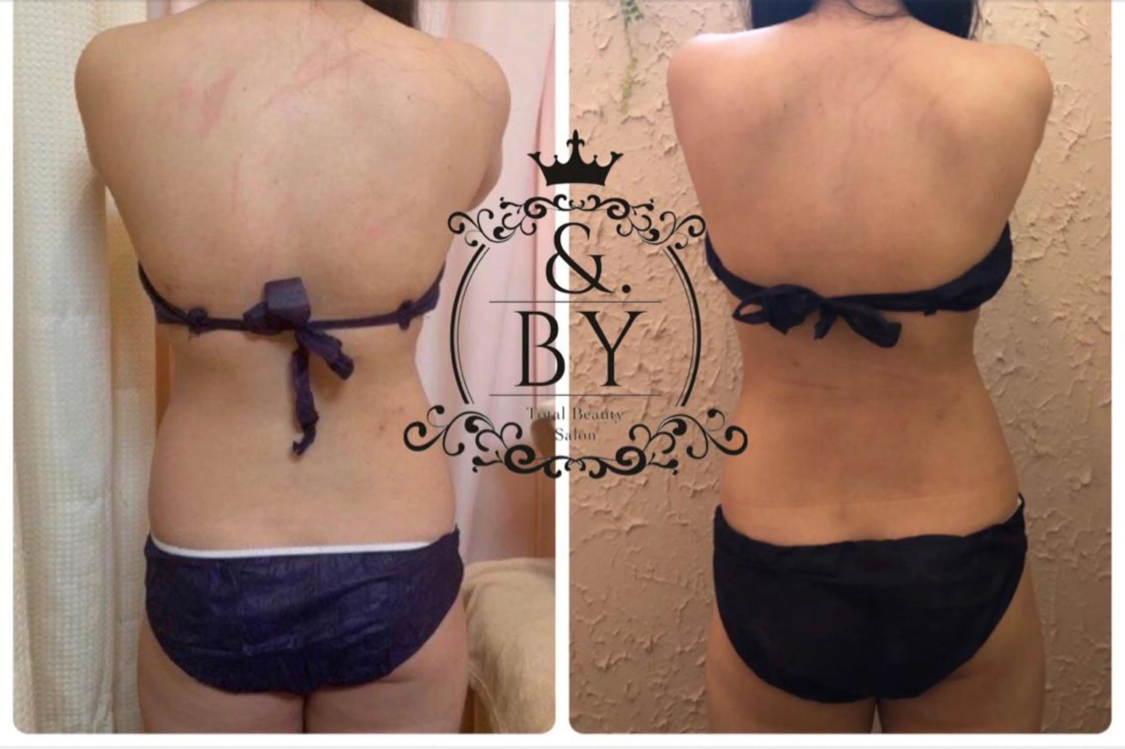 &. BYのエステ・リラクイメージ