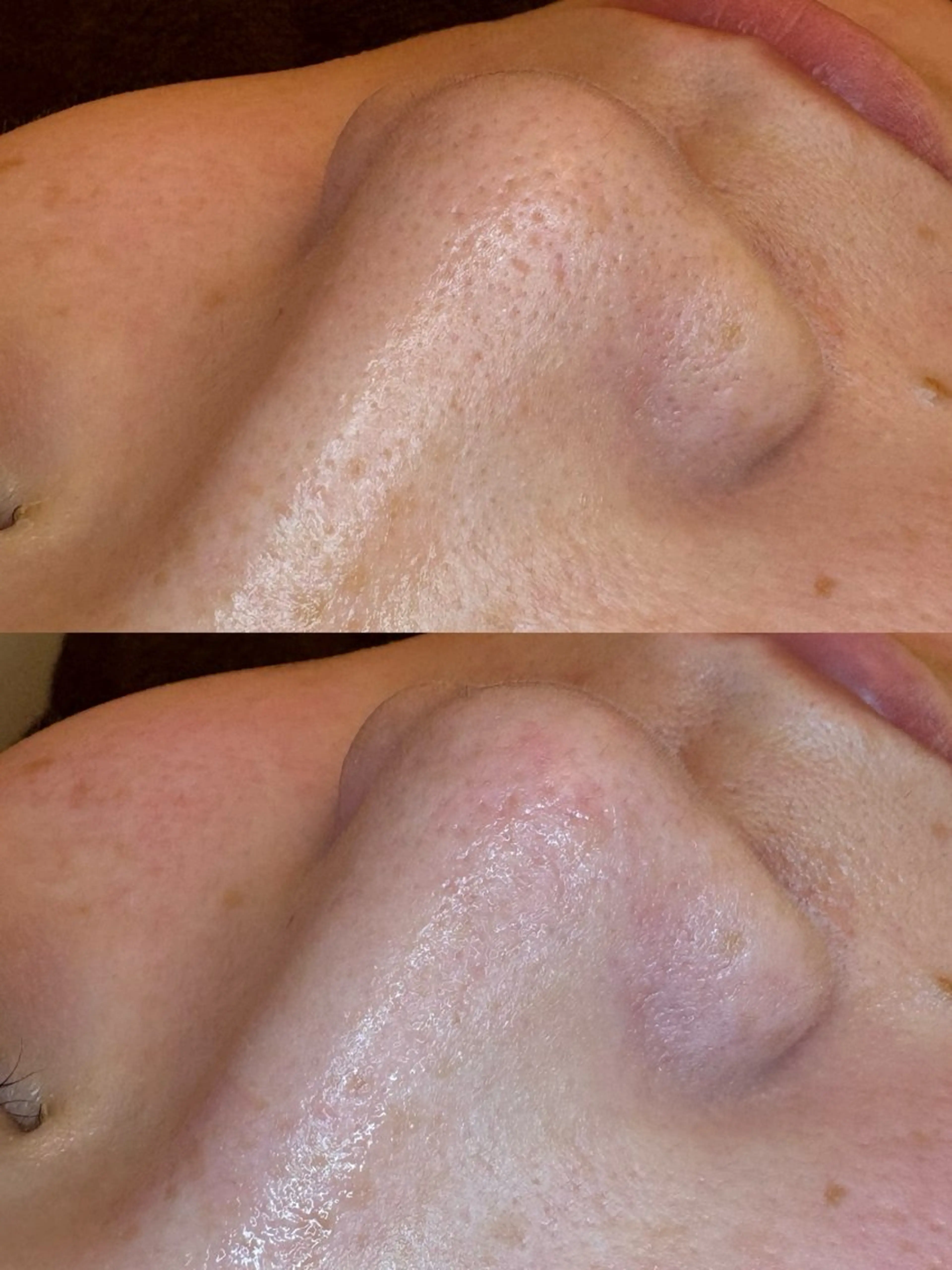 エステ EARTH coiffure beaute 新潟紫竹山店所属・🤍アベシュリ /フェイシャル🤍のエステ・リラクイメージ