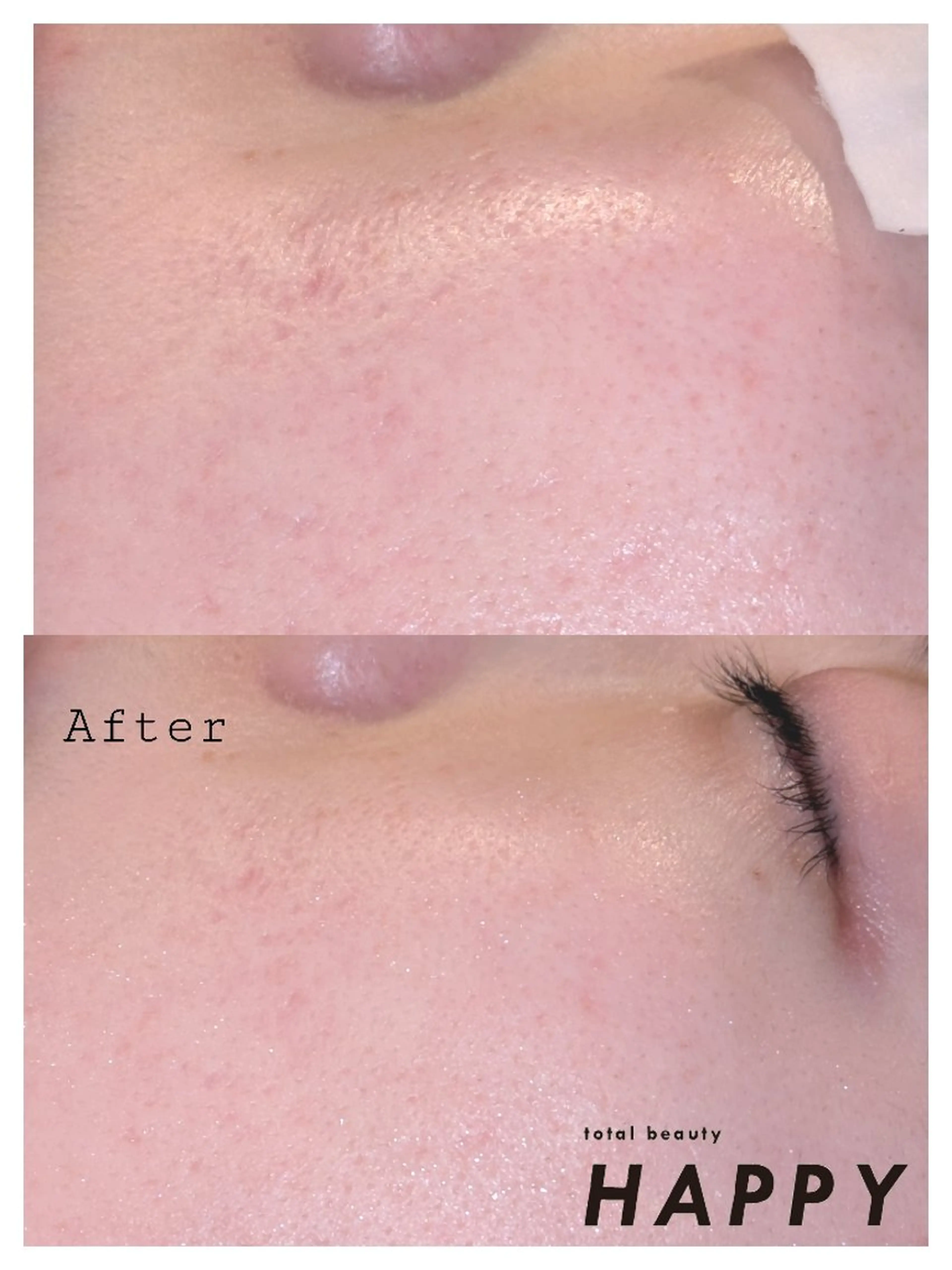 撮影モデル total beauty HAPPY所属・O. Minaのその他イメージ