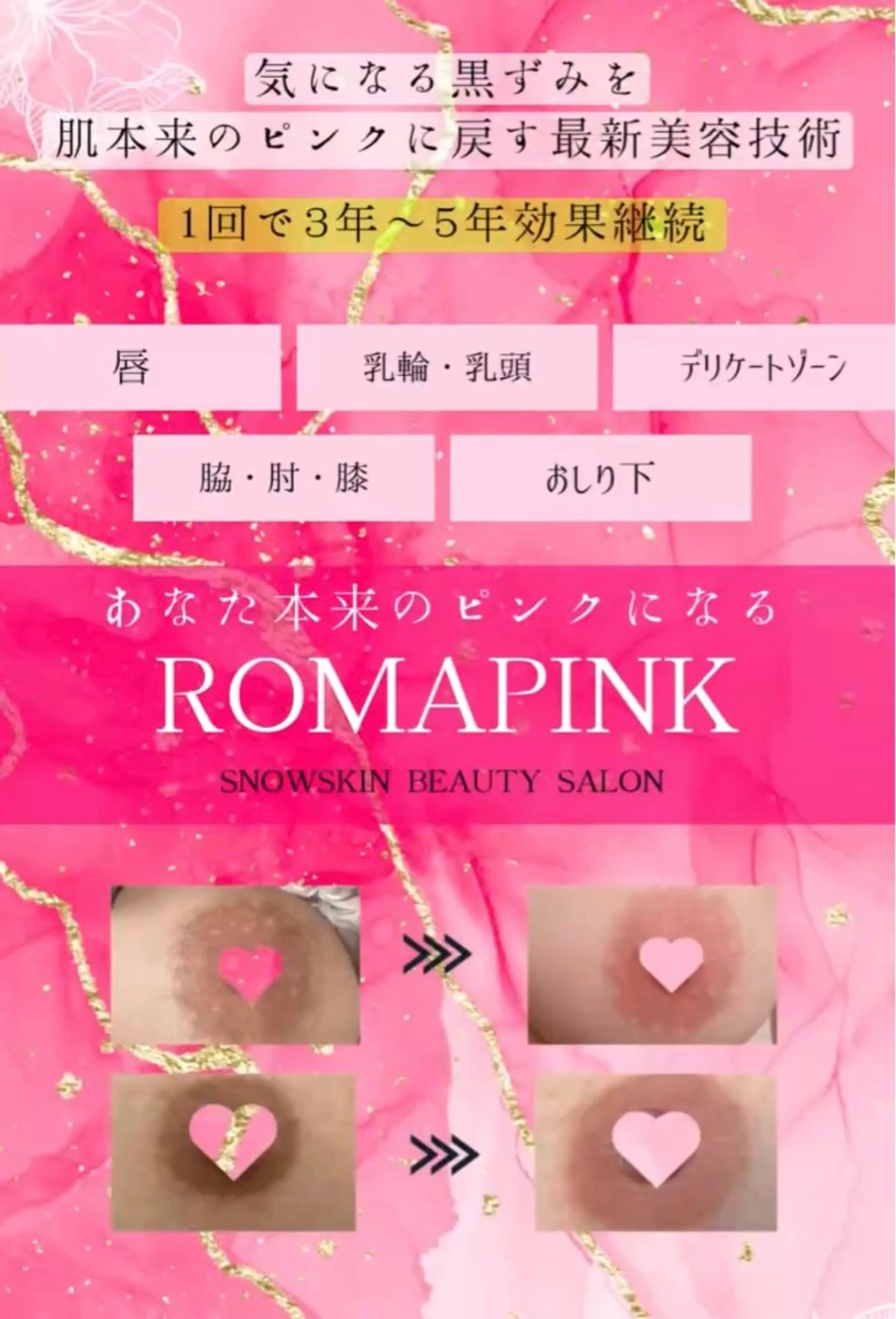 エステ ニキビ/肌質改善専門 Snow skinのエステ・リラクイメージ