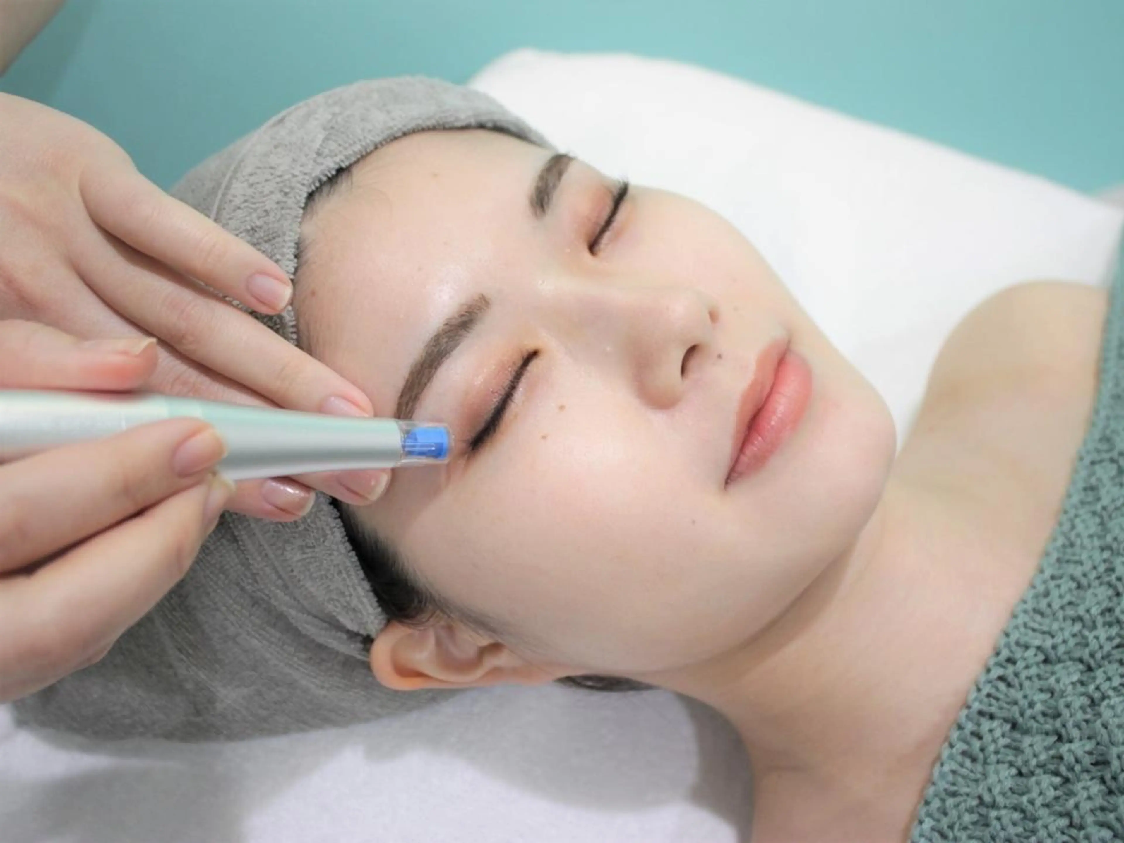 目元のシワぷっくりコース【ダーマペン使用】の写真