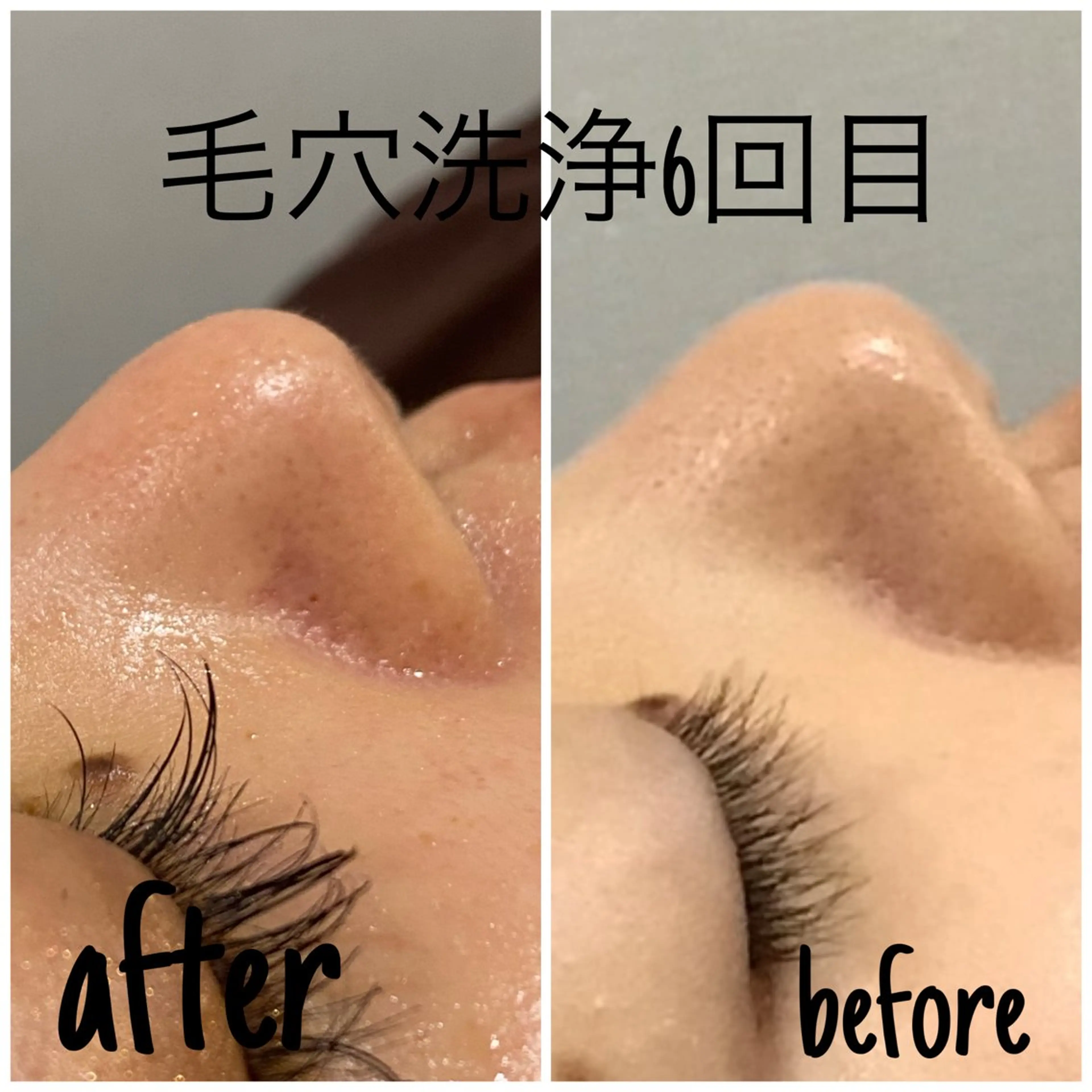 エステ 毛穴洗浄・痩身・脱毛 /アルカンジュのエステ・リラクイメージ