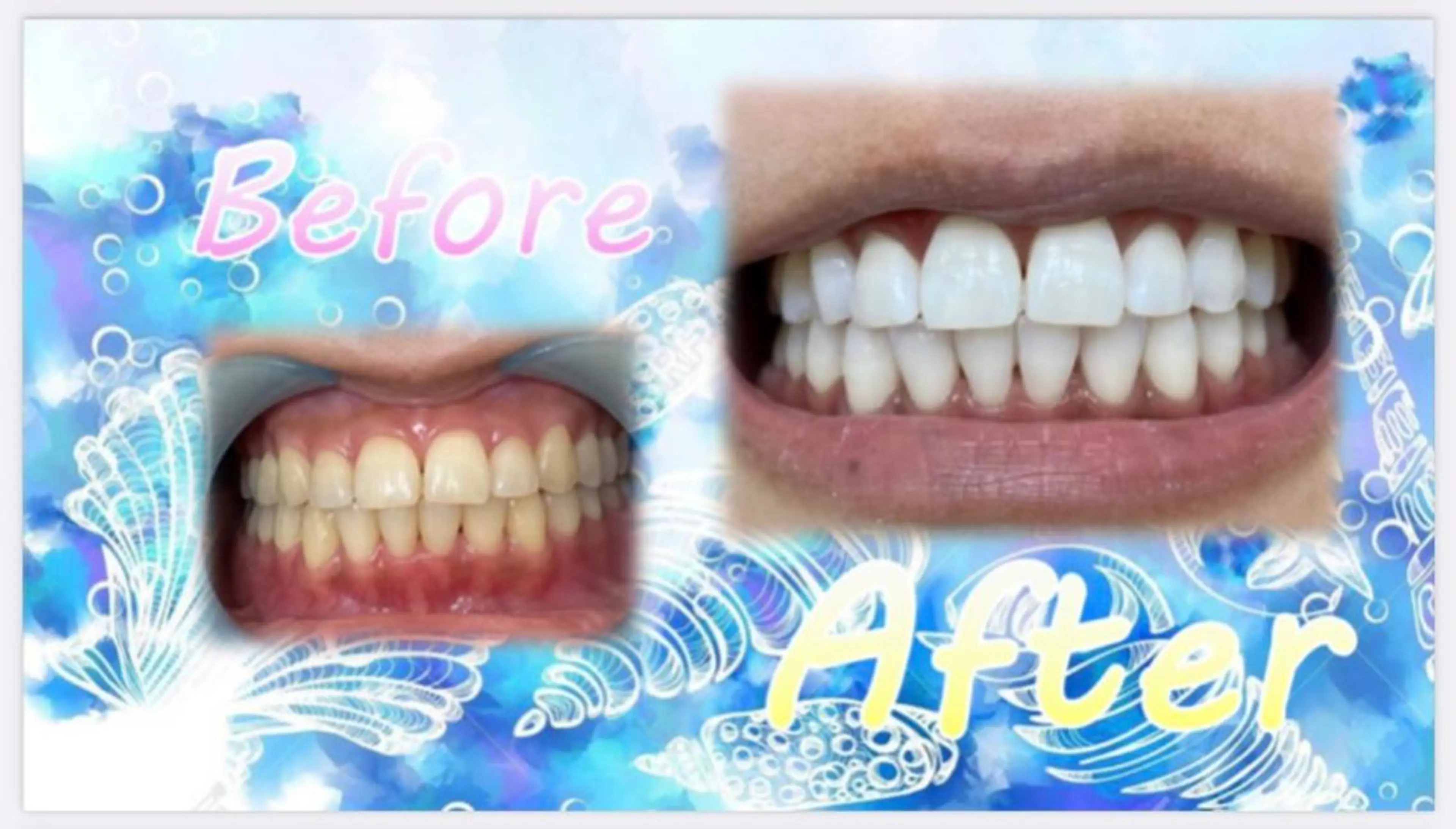 その他 セルフホワイトニングサロン　ラヴィアン所属・ホワイトニングサロン La vie enのその他イメージ