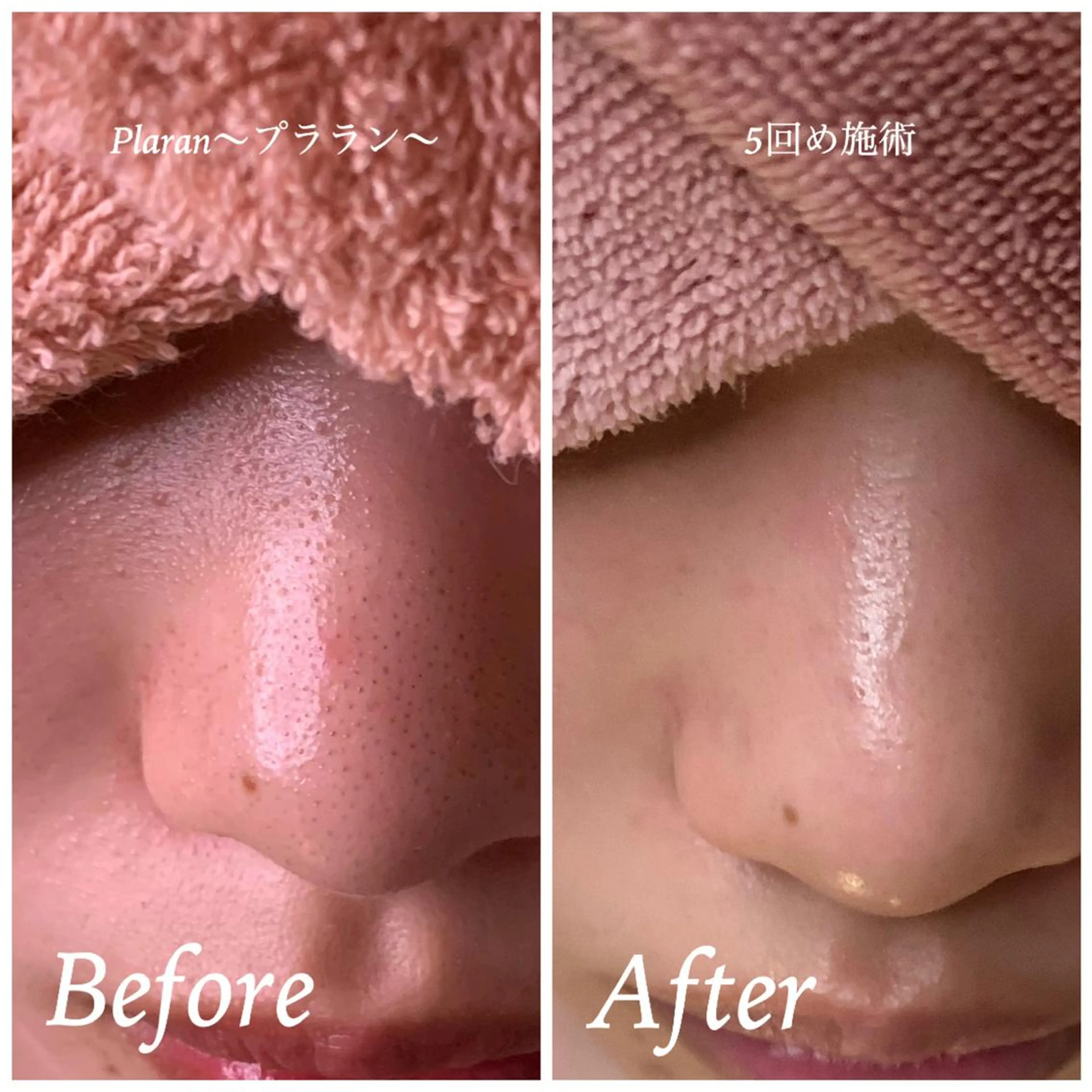 Plaran 〜プララン 〜のその他イメージ