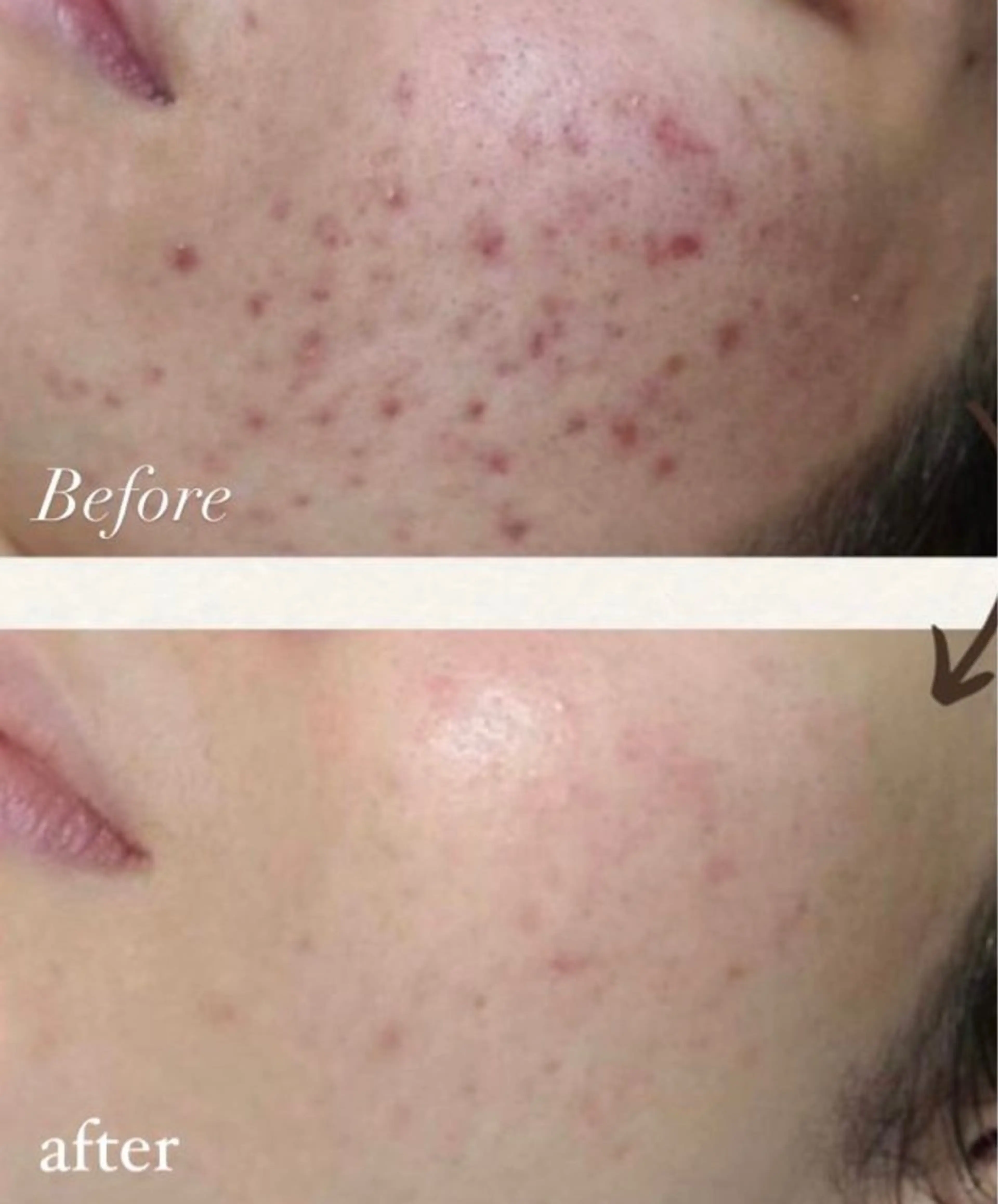 エステ Lam.. .のエステ・リラクイメージ