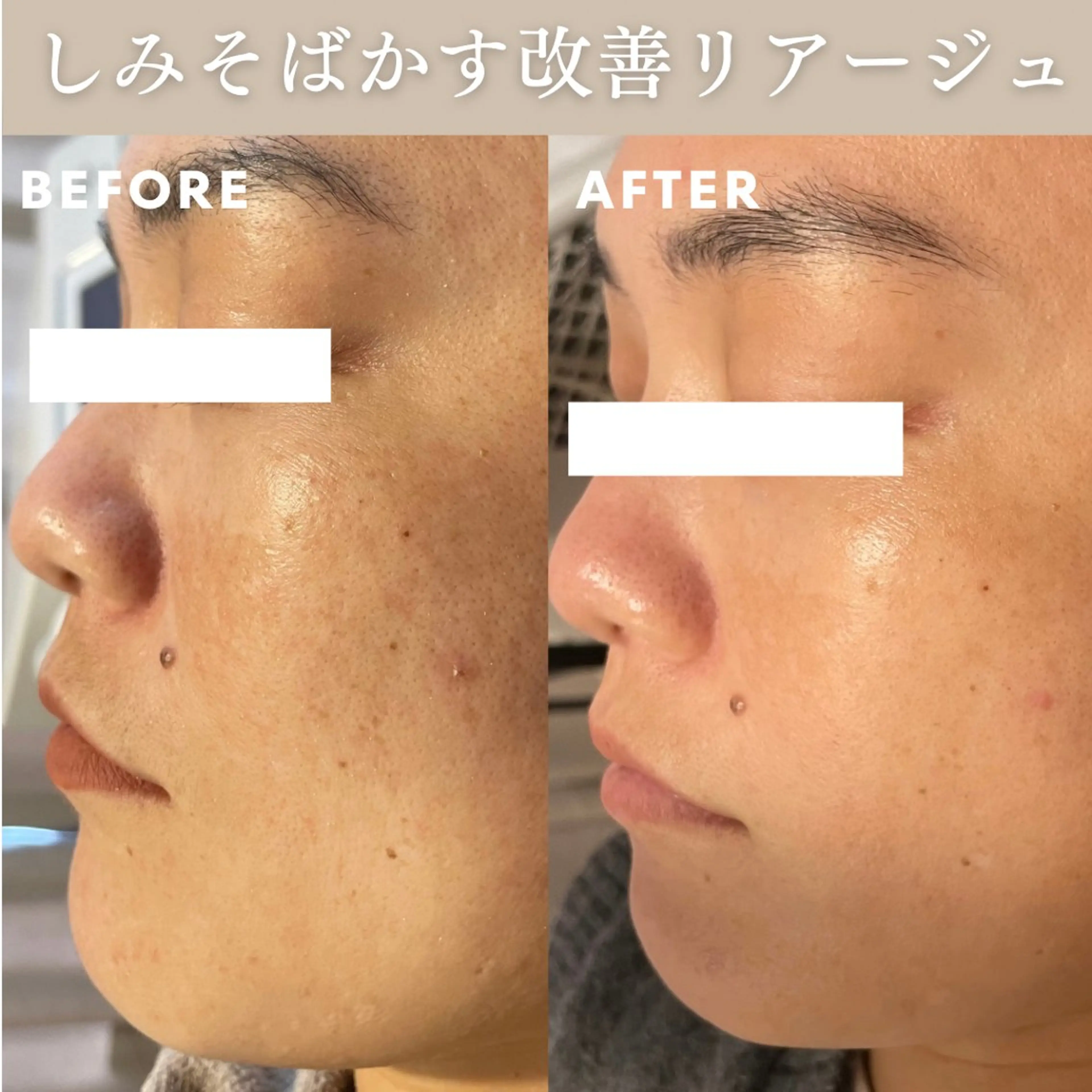 エステ Lassy Yuriの眉毛・アイブロウイメージ