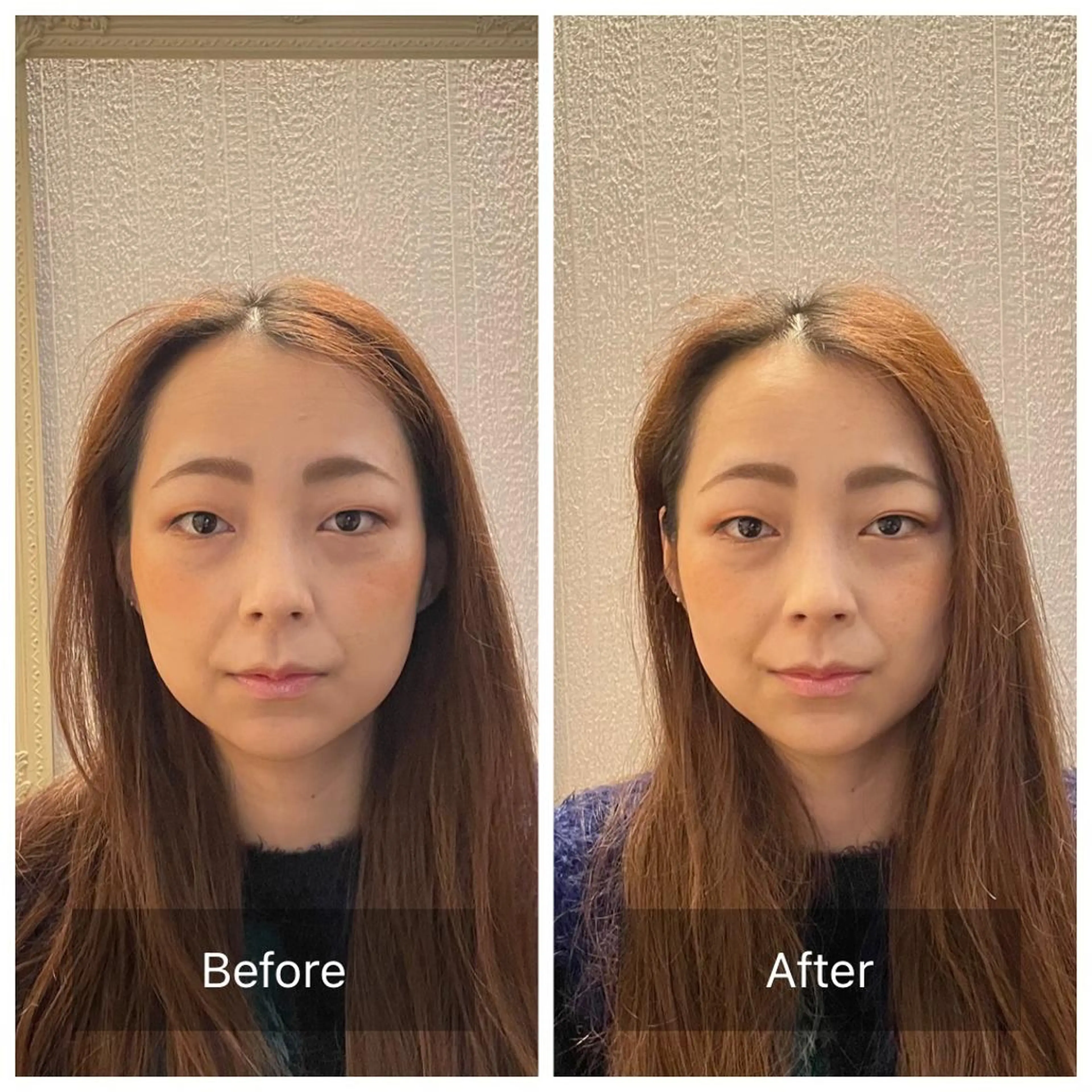 美容鍼　蒼月-aotsuki-所属・美容鍼「蒼月」 -アオツキ-のエステ・リラクイメージ