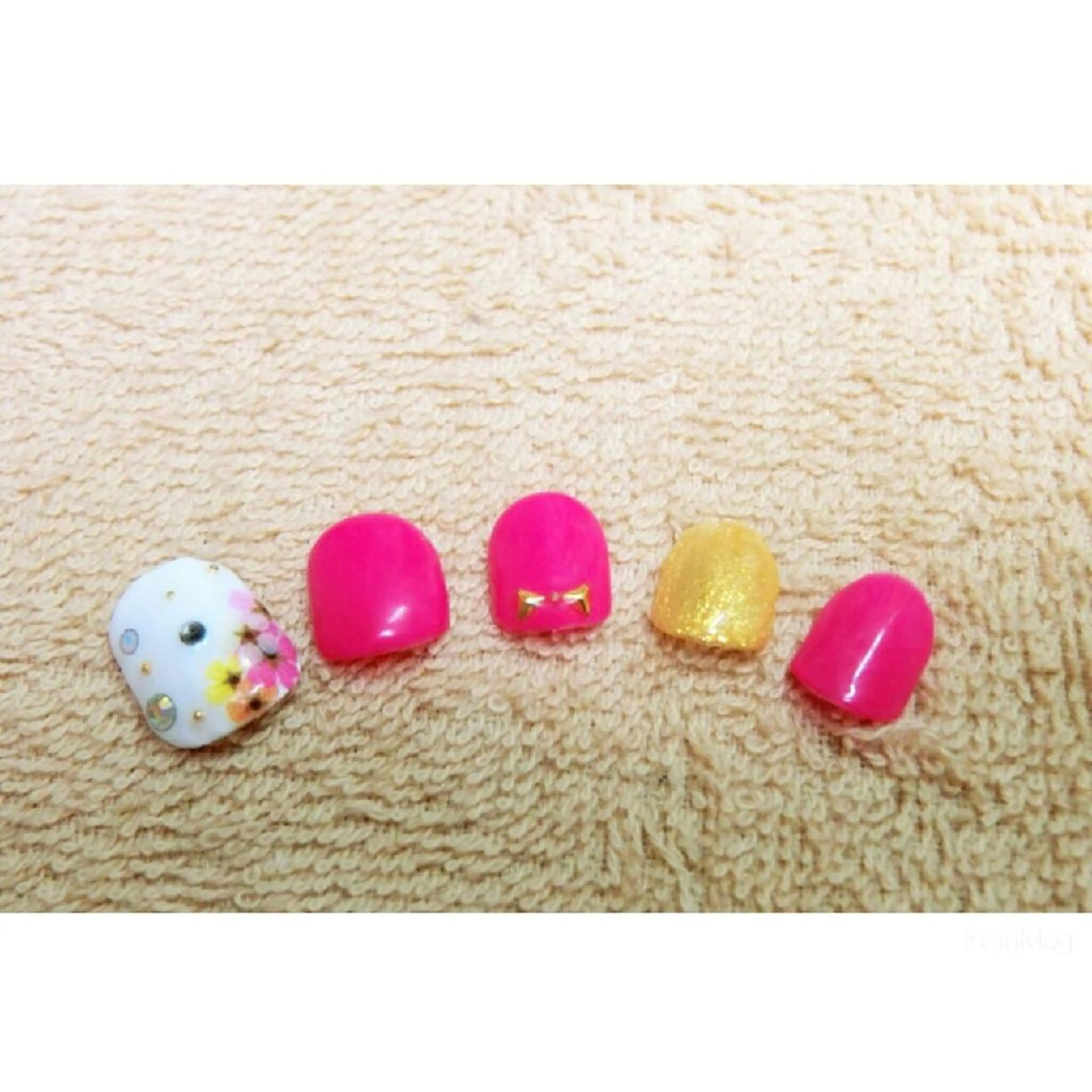 ネイル フットネイル 痛ネイル/ワンホン/ フィルイン/長さだしのネイルデザイン