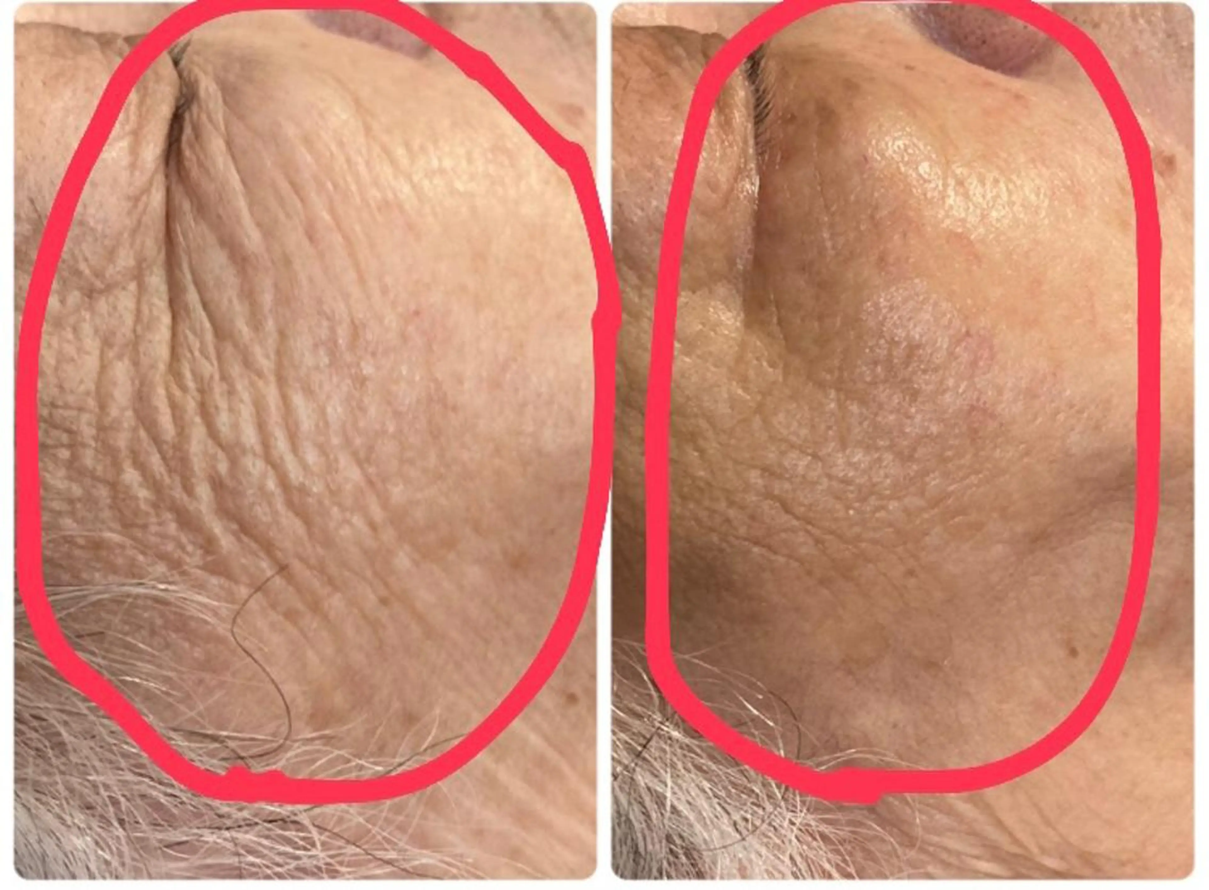 ナリス化粧品De I’mあべのルシアス所属・山本 紗織のエステ・リラクイメージ