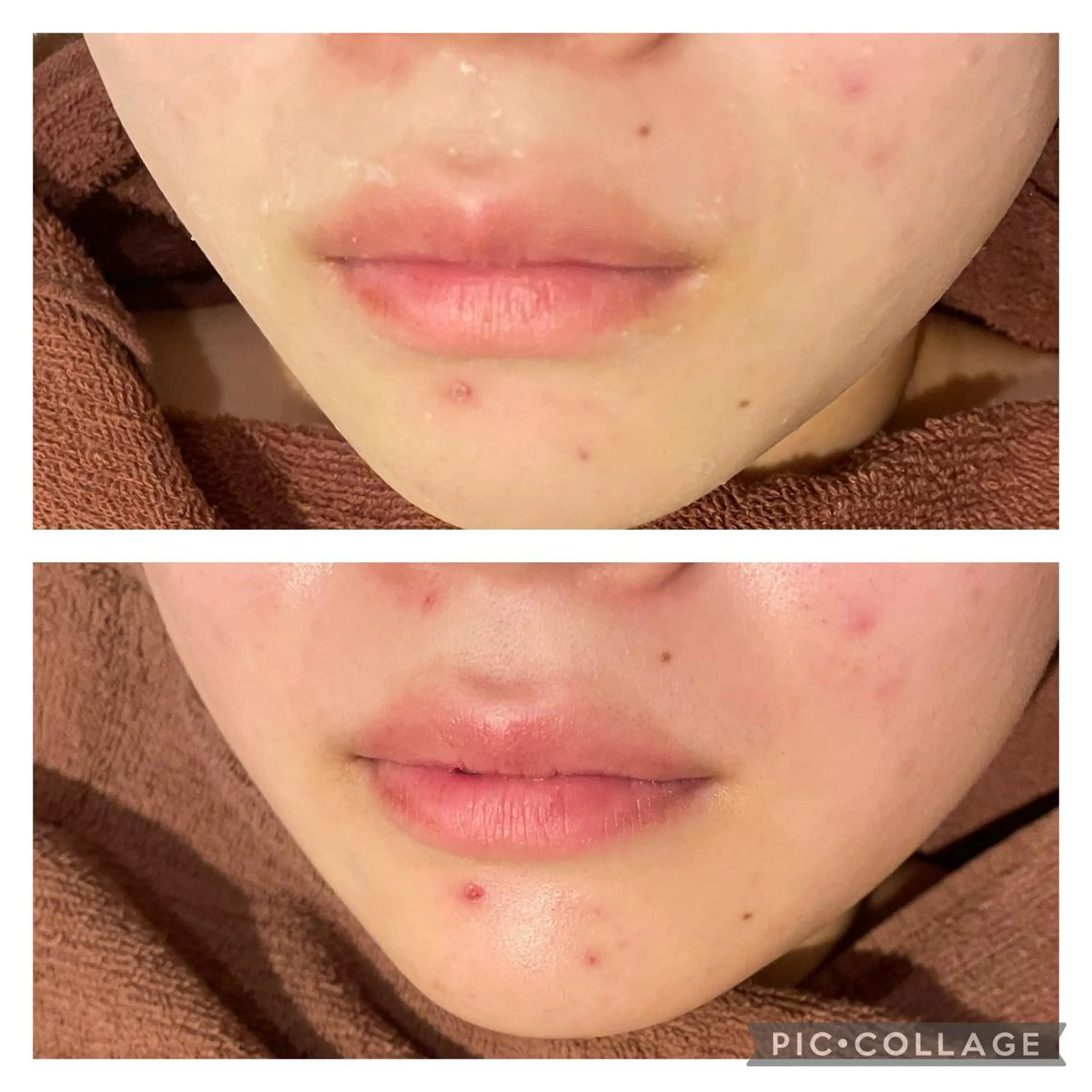 ミディアム カラー パーマ ヘアアレンジ メンズ キッズ ネイル マツエク・マツパ アイブロウ エステ リラク ニキビ特化型エステ 🍓最短で肌質改善のエステ・リラクイメージ