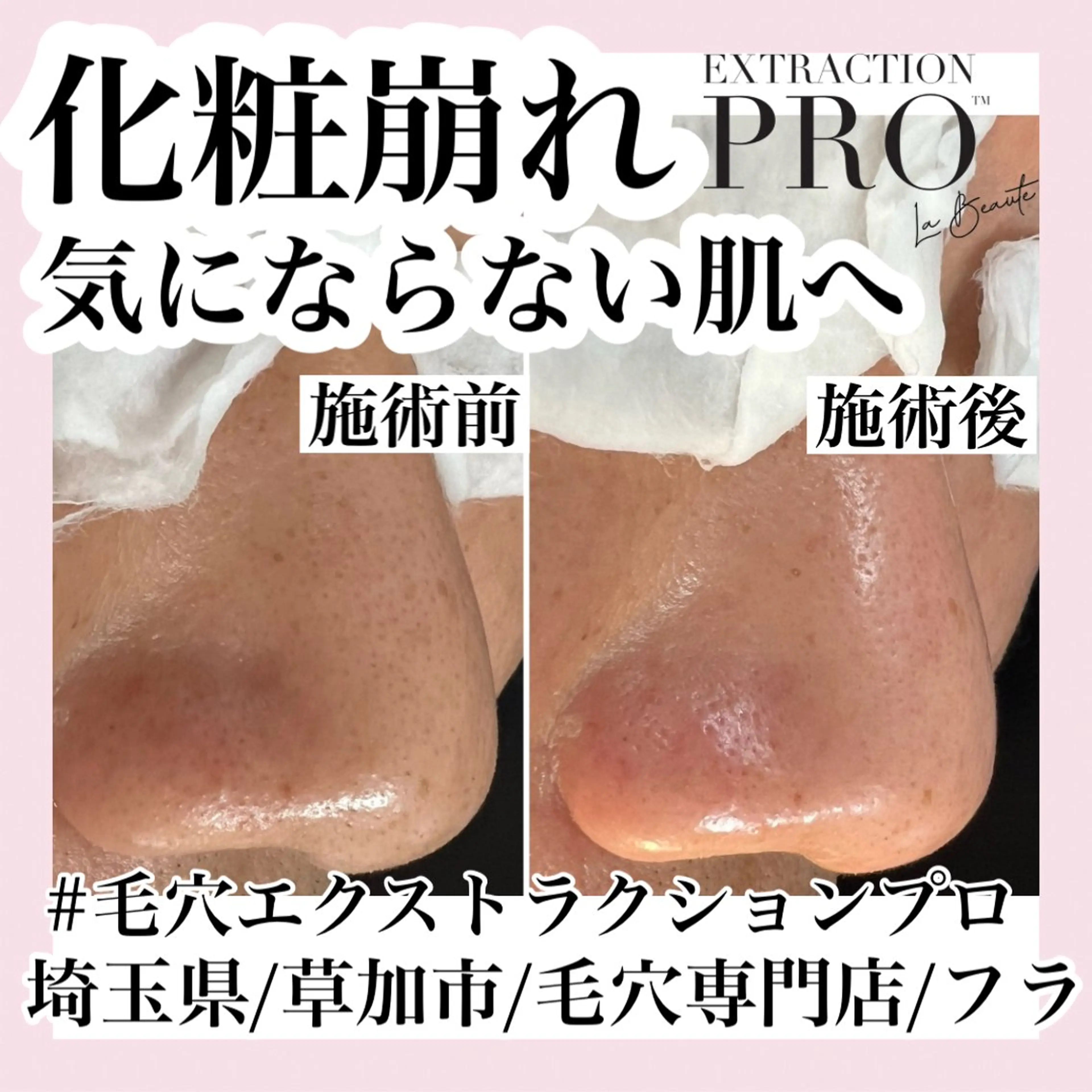 毛穴専門店hula 杉山智美のエステ・リラクイメージ