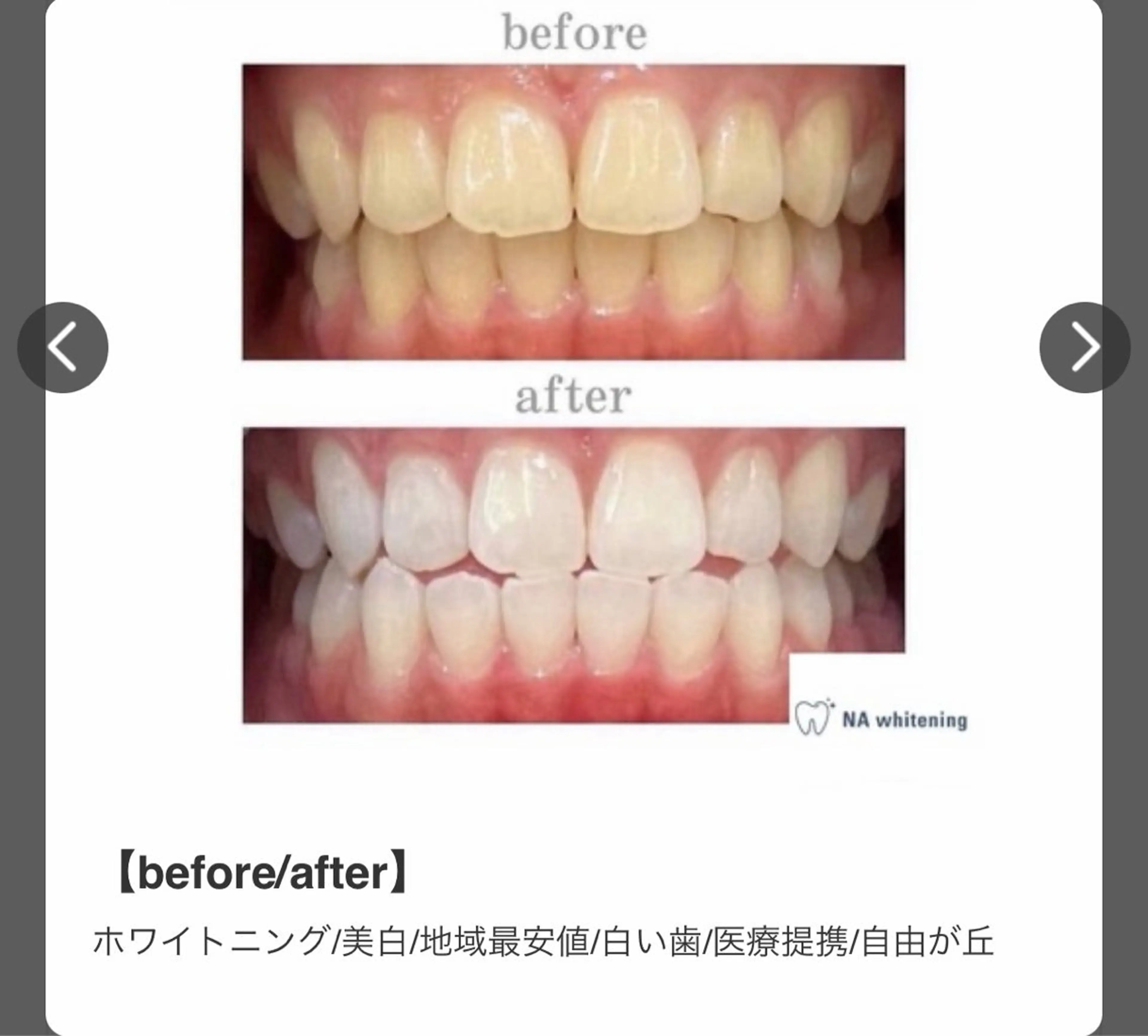 エミルカ　自由が丘店所属・ニキビ改善ハーブ🌿 ハナシマのその他イメージ