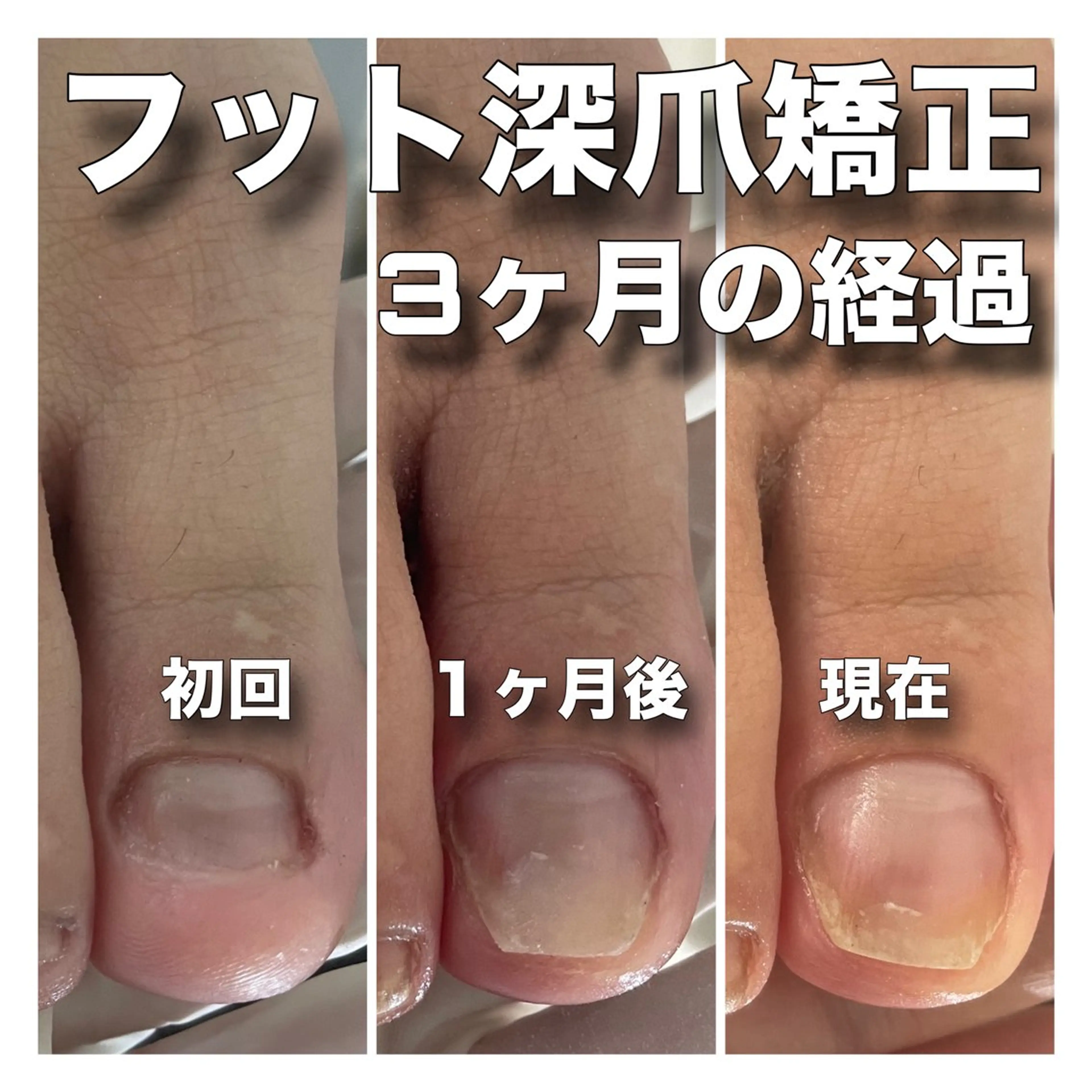 ネイル 成人式 ブライダルネイル petillant所属・nail salon petillantのネイルデザイン