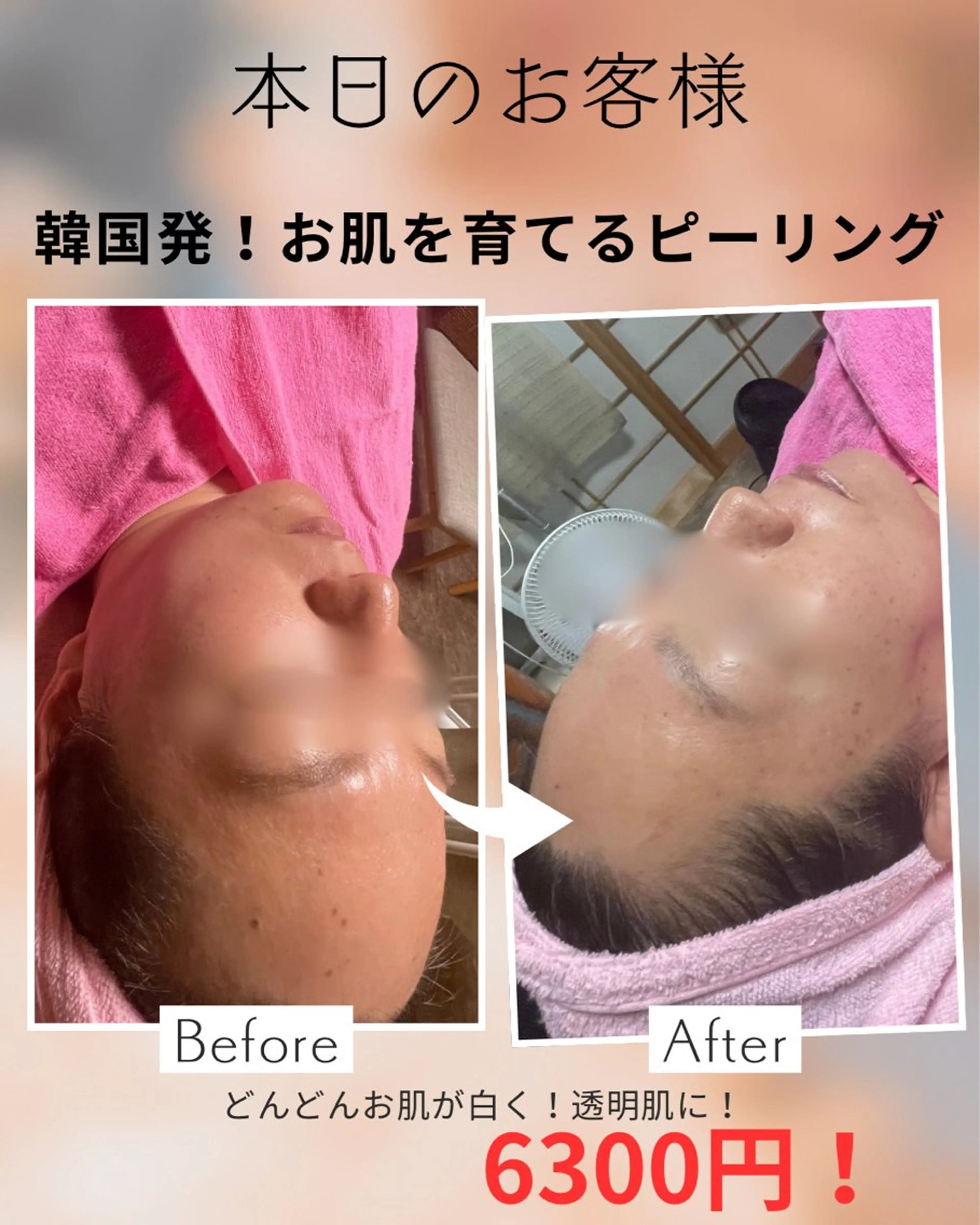 エステ 韓国肌&ララピール シミケア　せんすのエステ・リラクイメージ