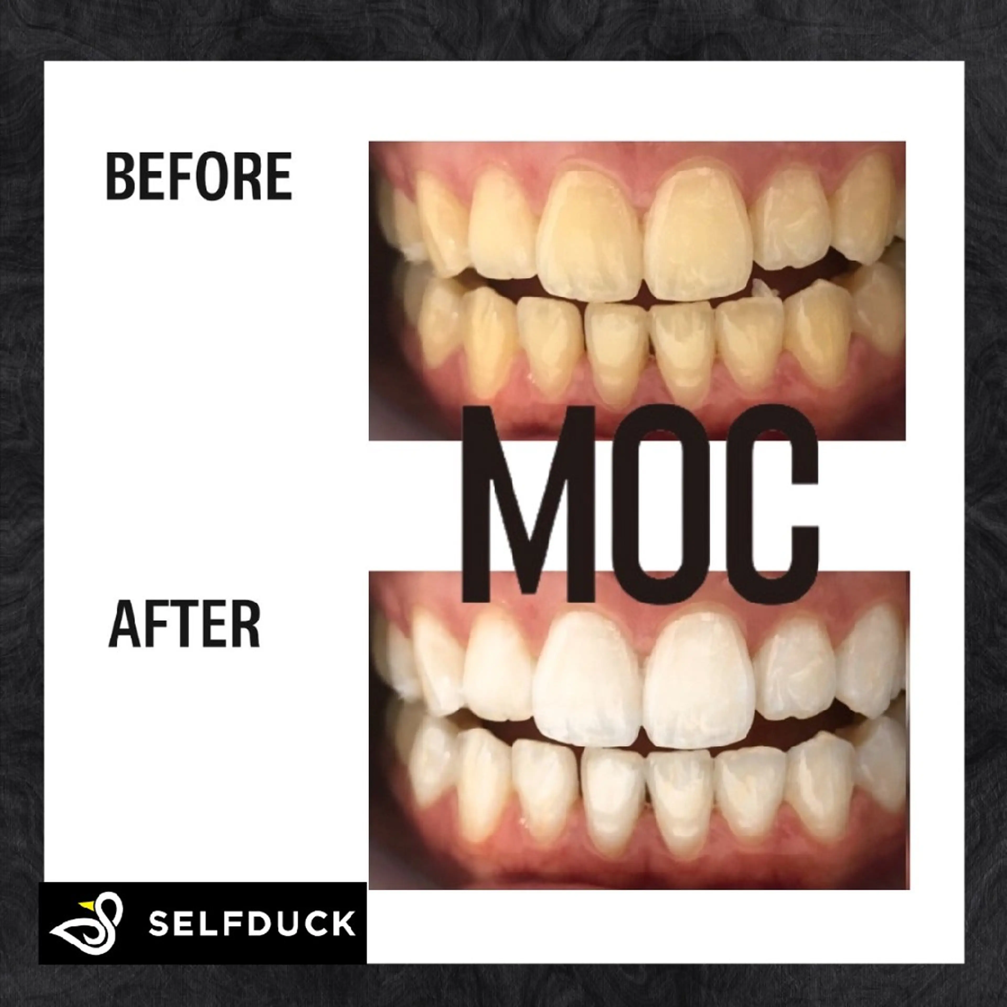 歯科提携セルフダック 宇都宮駒生店のエステ・リラクイメージ