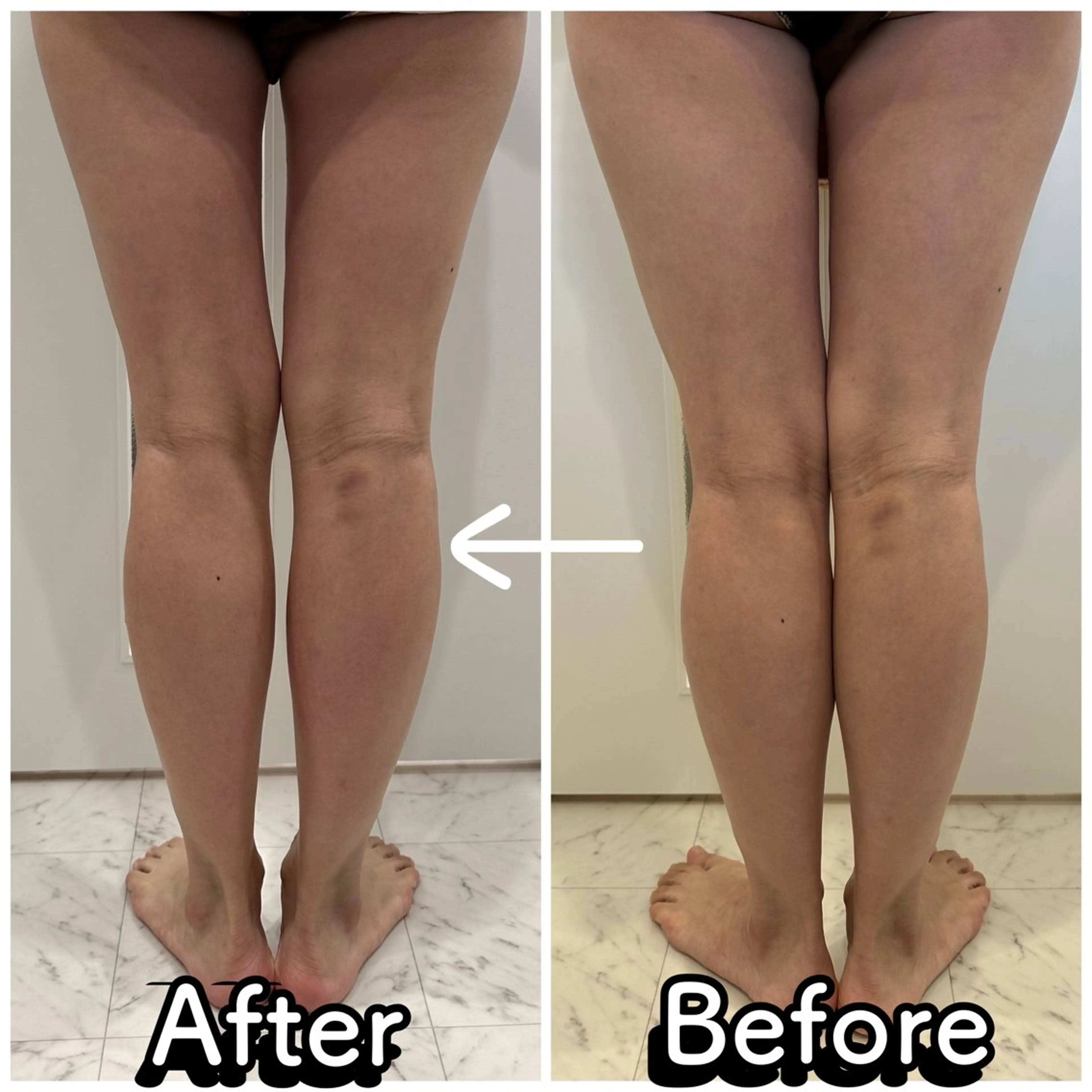 【レディース】40分フットリンパマッサージ（オイル）の写真