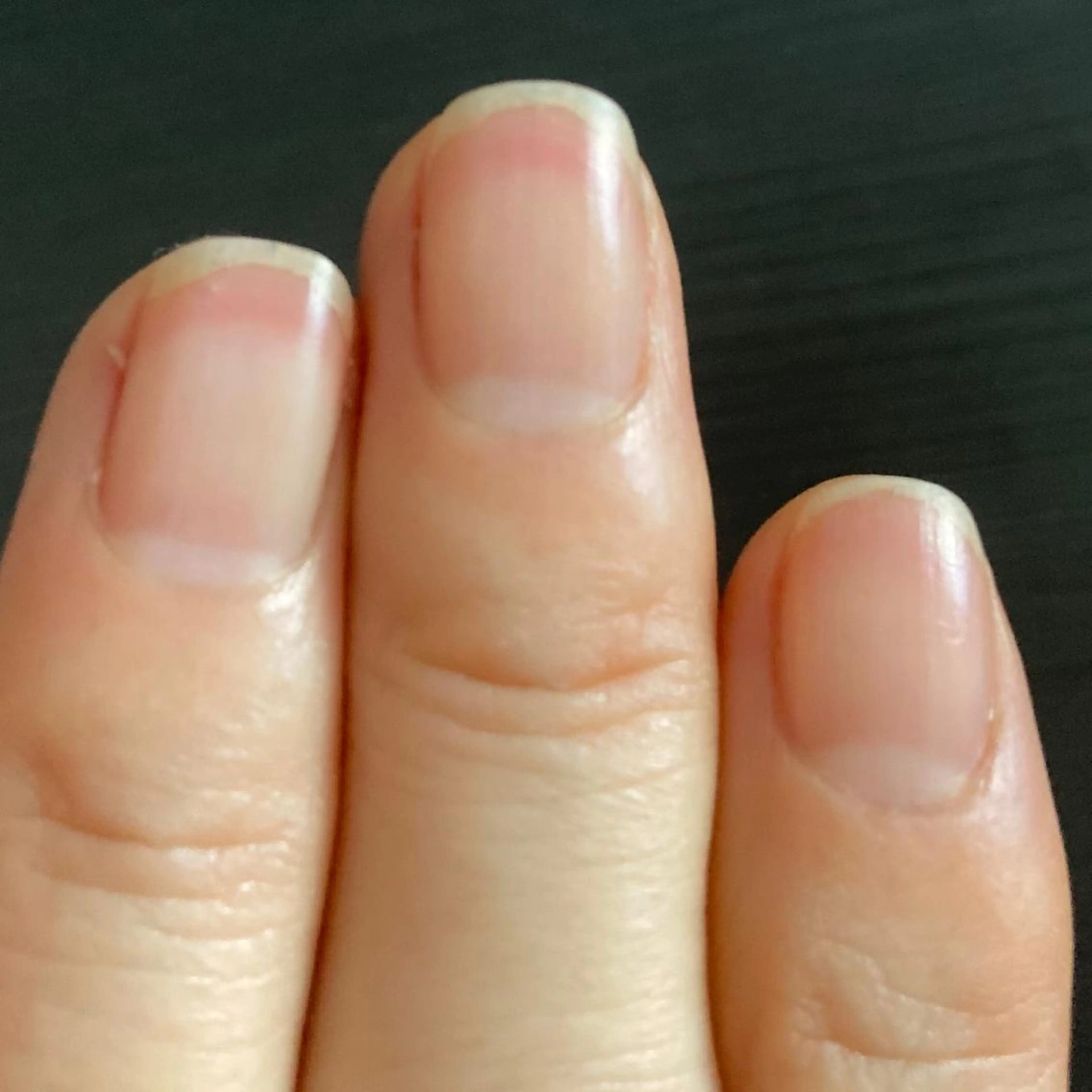 ネイル ハンドケア＆ネイルケア桃の木所属・ケアリスト🍀 マリユキのネイルデザイン