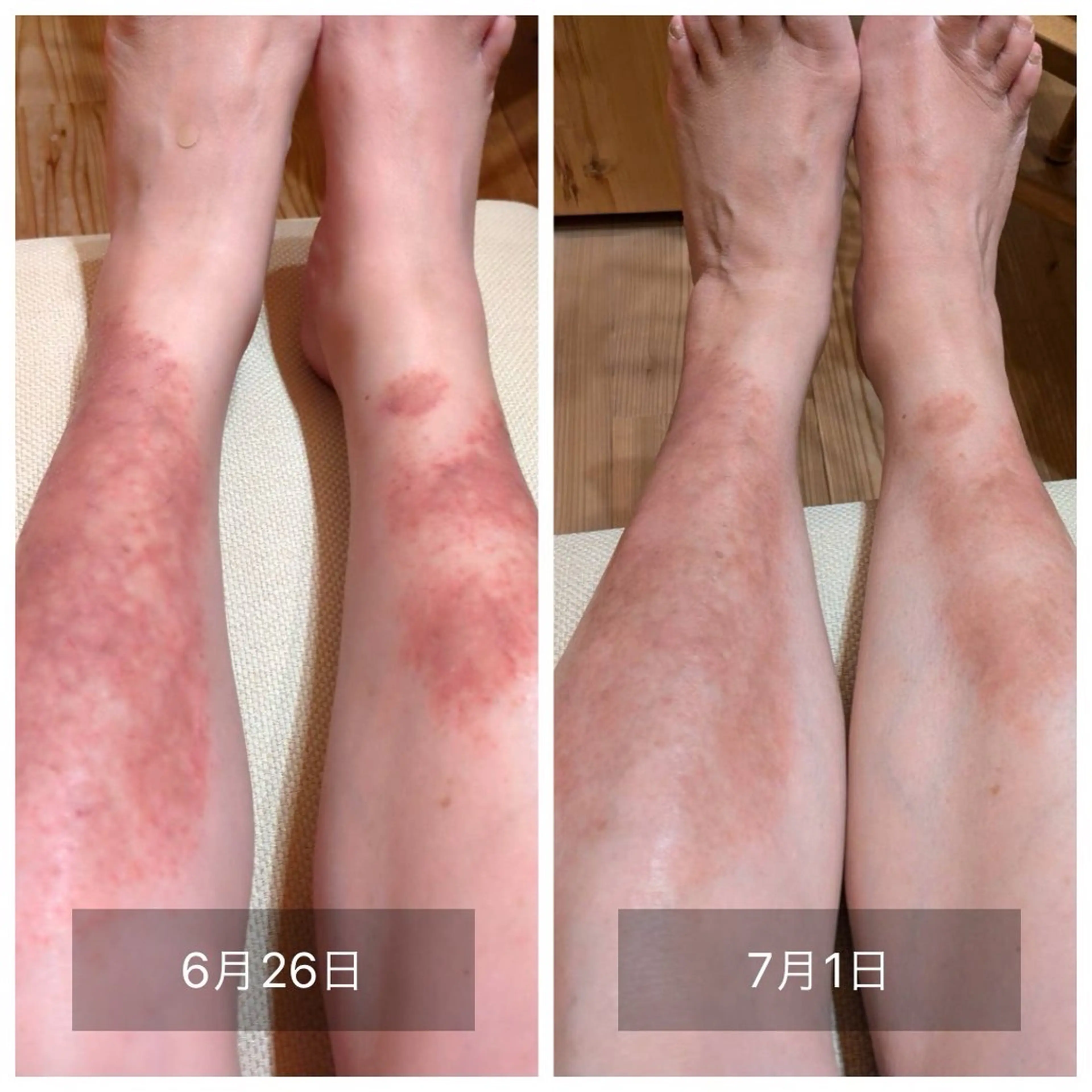 エステ リラク nouvelle  plume所属・ヌーベル プリュムのエステ・リラクイメージ