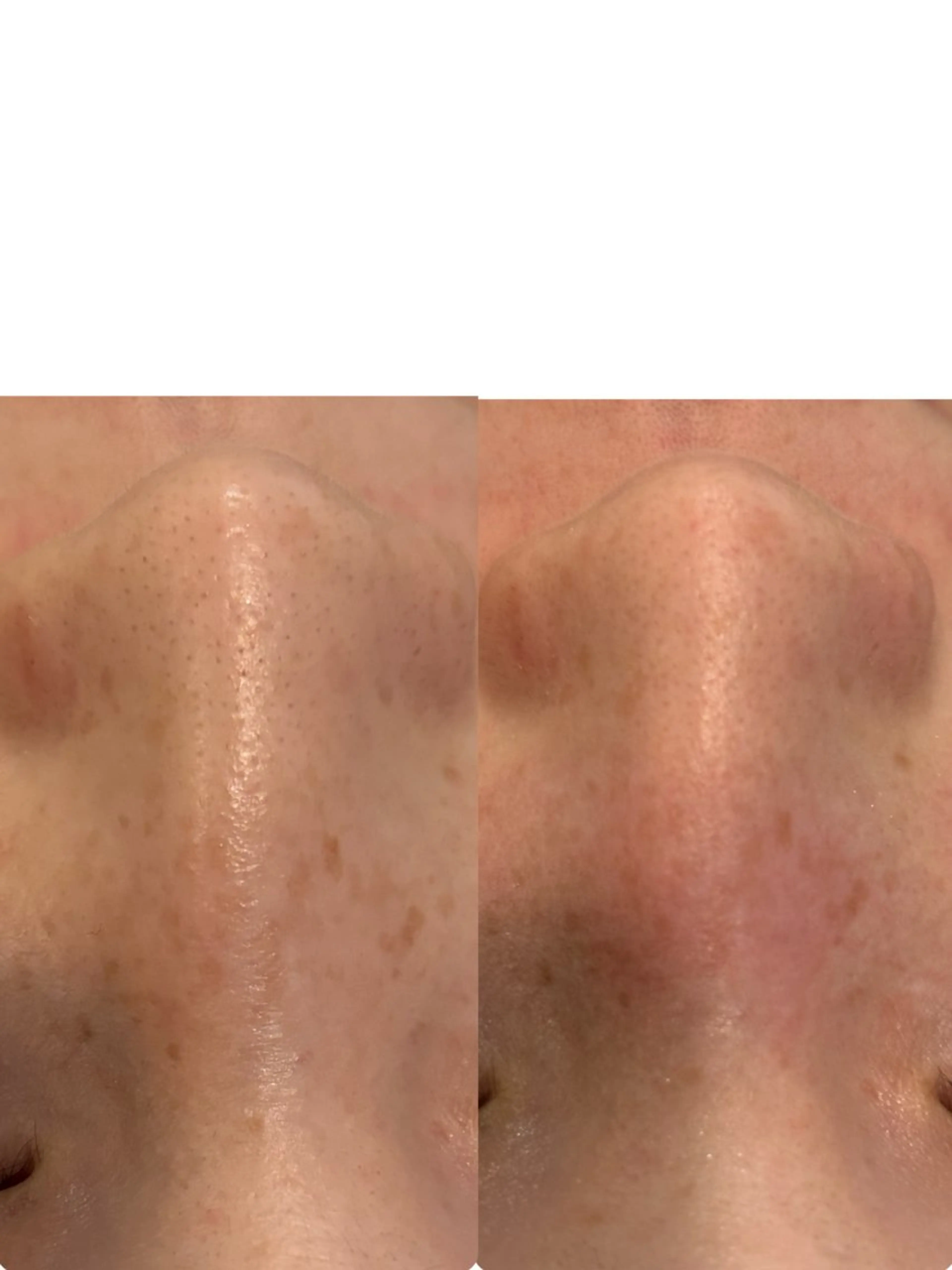 Fulala 永田のエステ・リラクイメージ