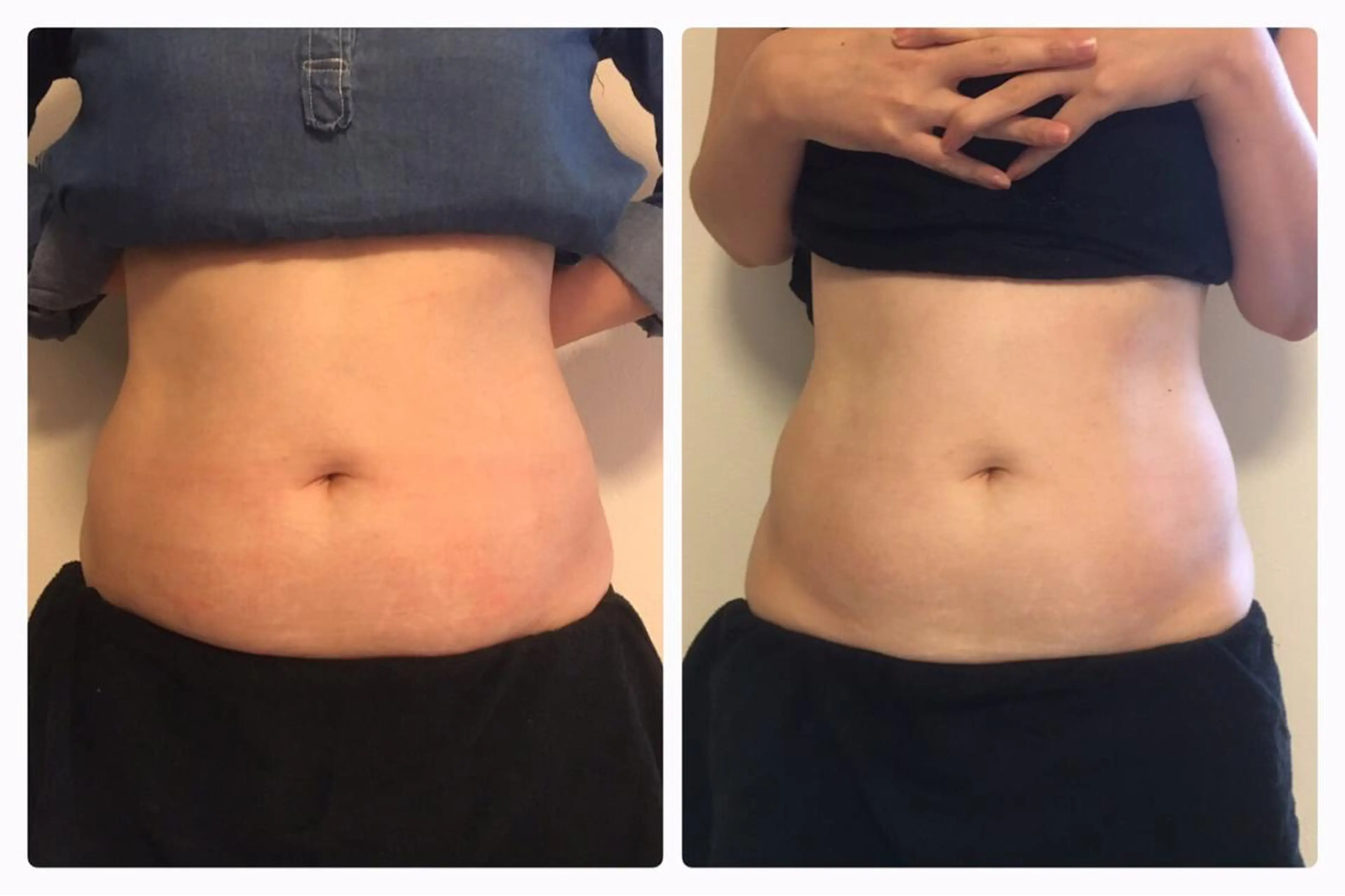 ESPOIR エスポワールのエステ・リラクイメージ