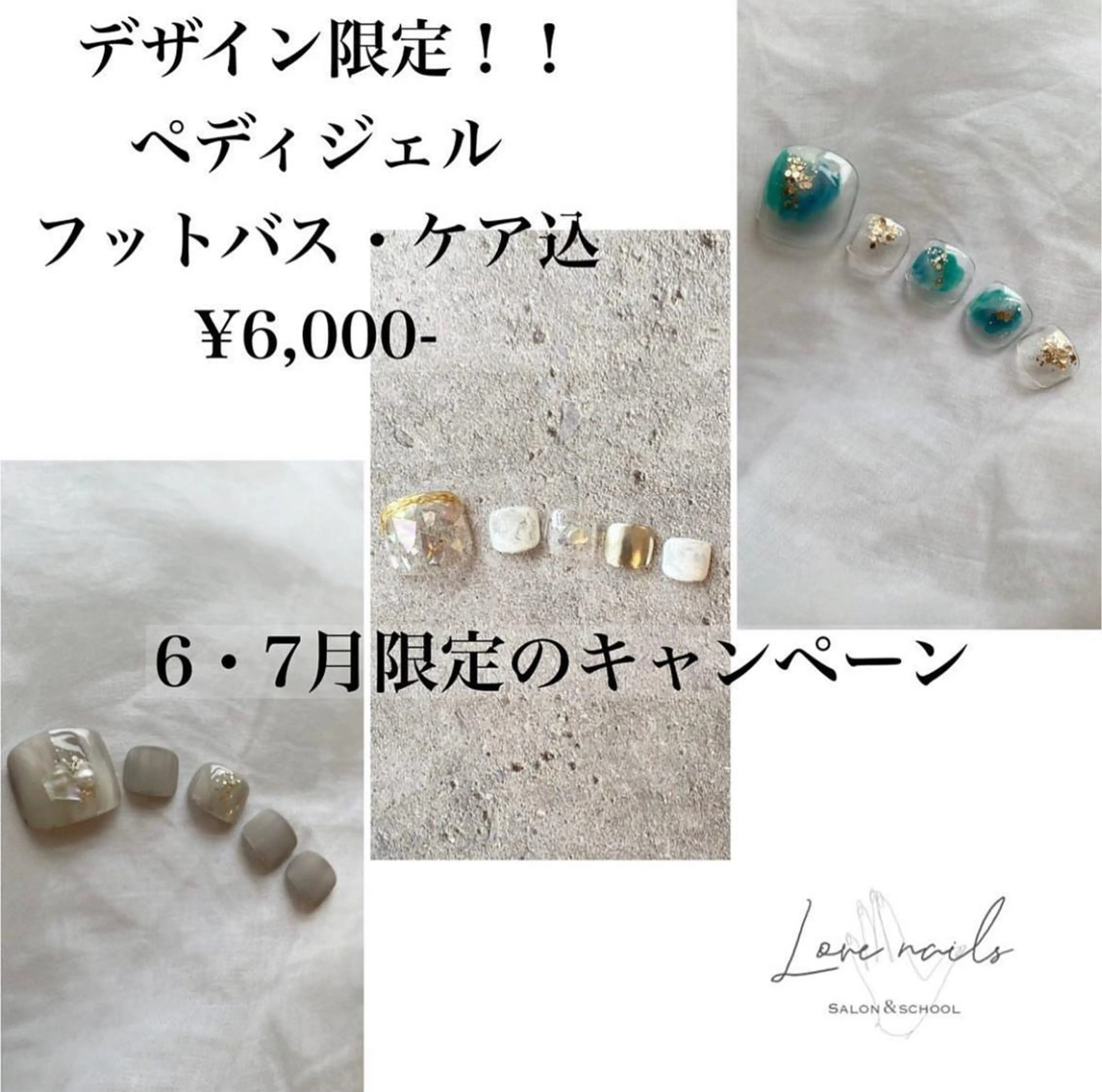 デザイン限定フットジェルネイルの写真