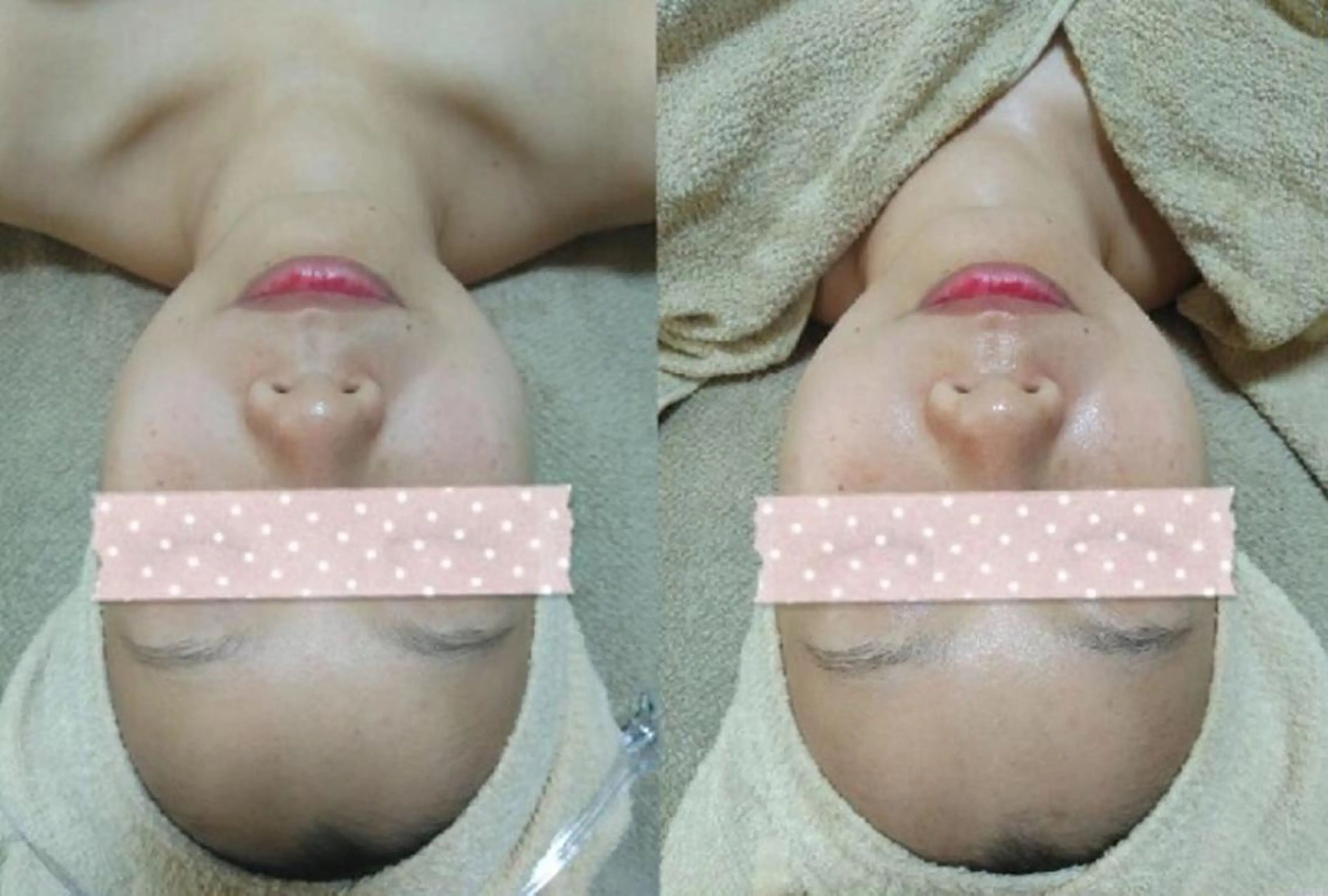 【エイジング】光フェイシャルとハンドで癒されながらキレイにの写真