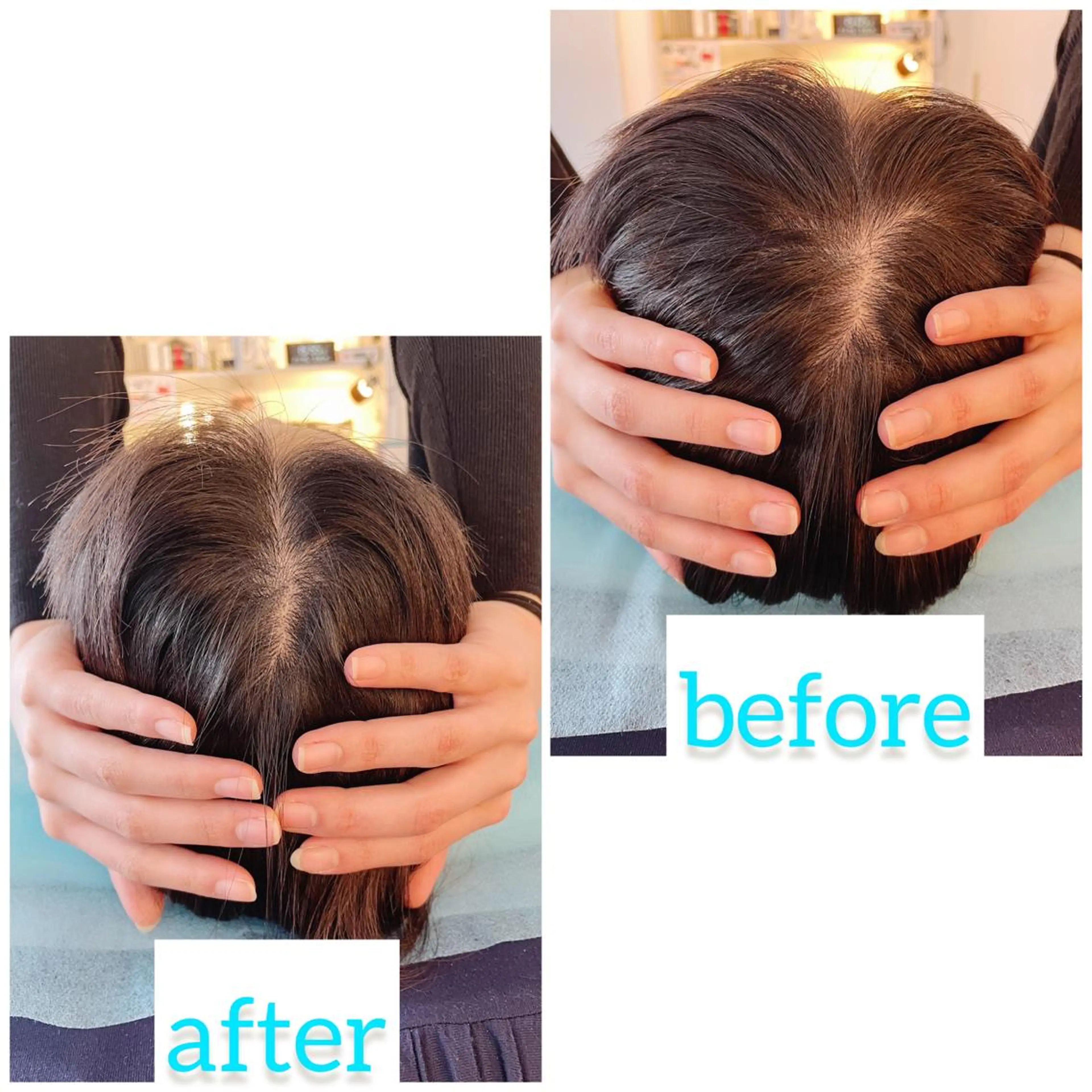 エステ リラク 小顔美容鍼専門サロン 渋谷YZのその他イメージ