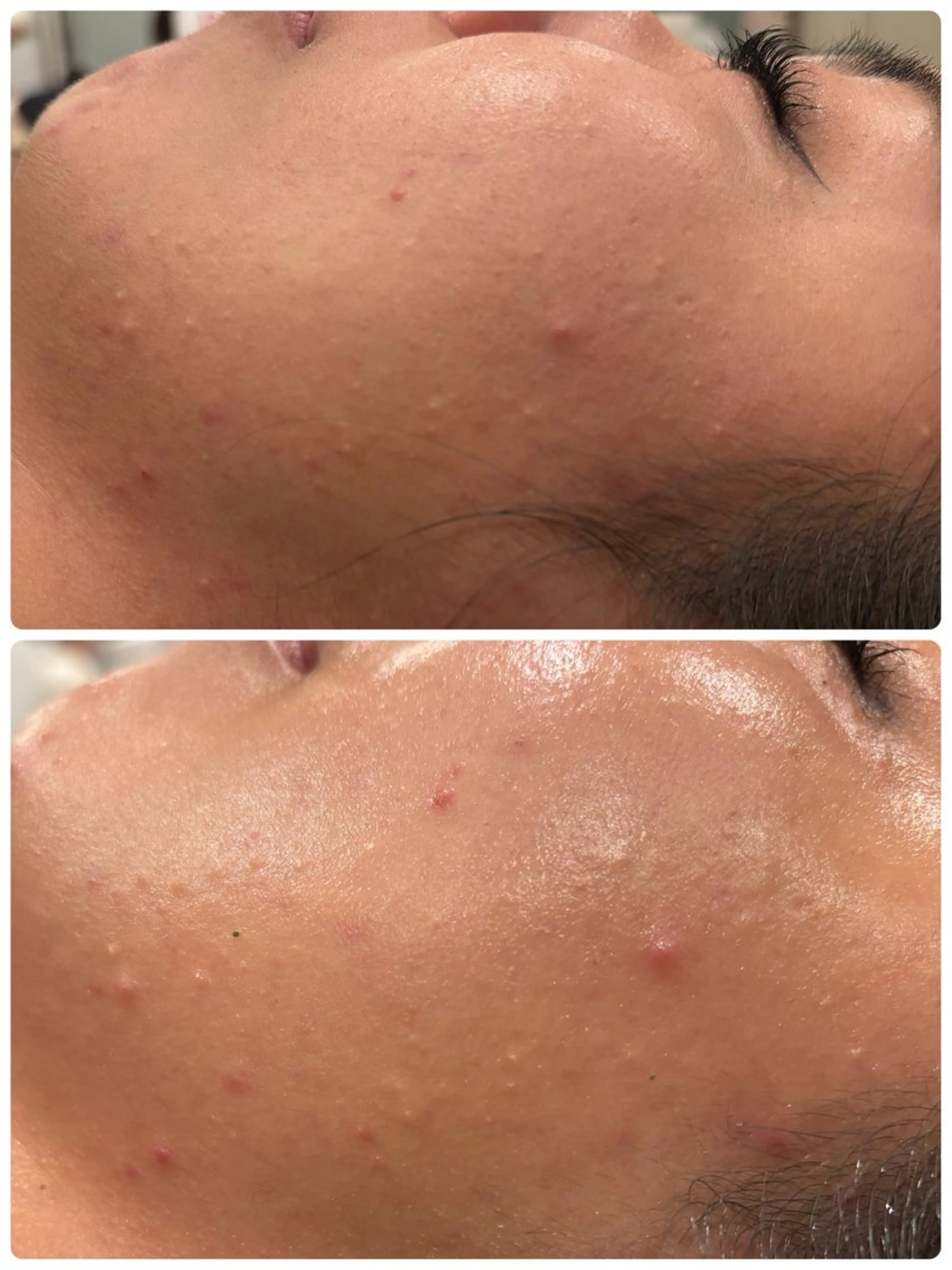 Mind care&stretch所属・Mizyu ハーブピーリングのエステ・リラクイメージ