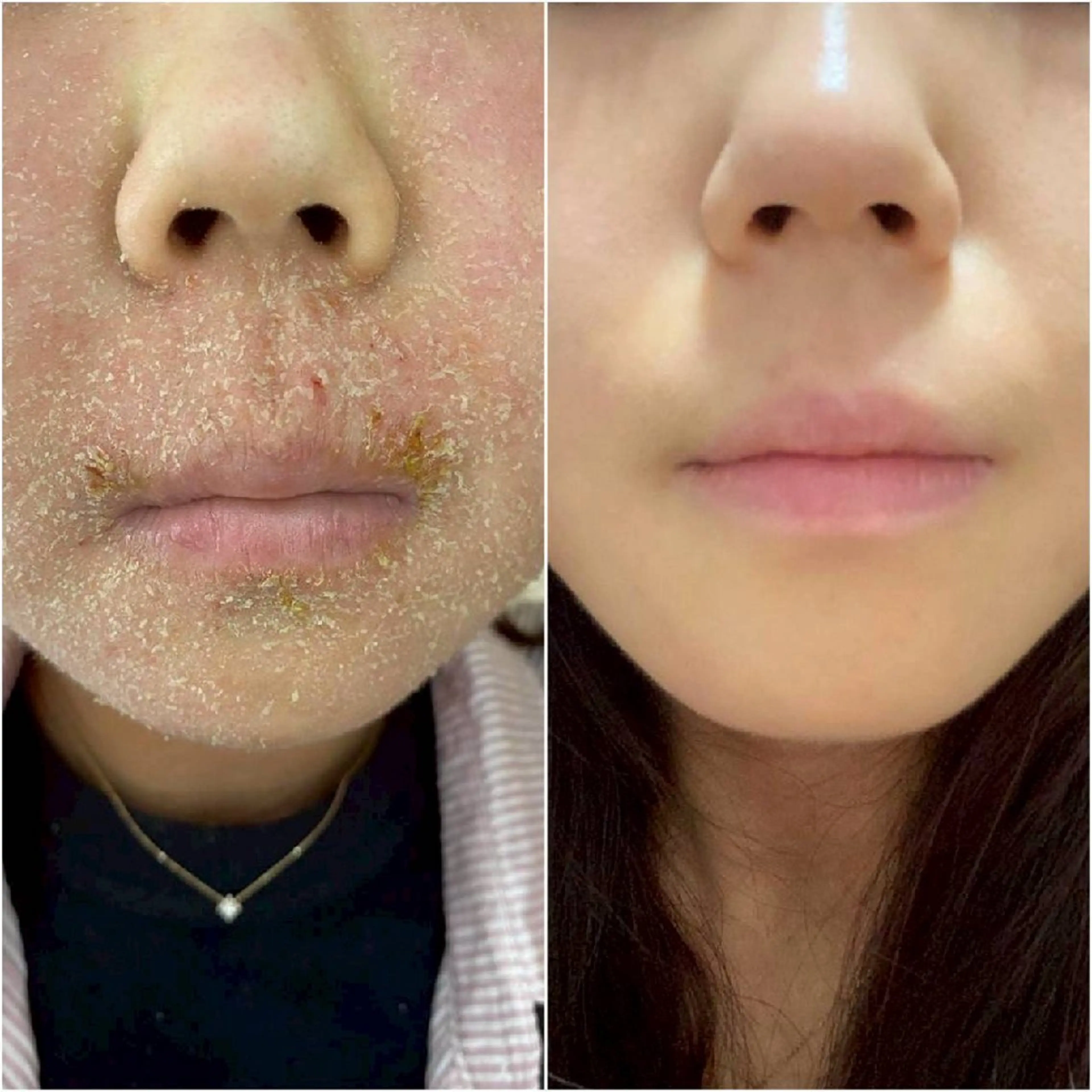 エステ 夜限定SARON 💎YISM💎のエステ・リラクイメージ