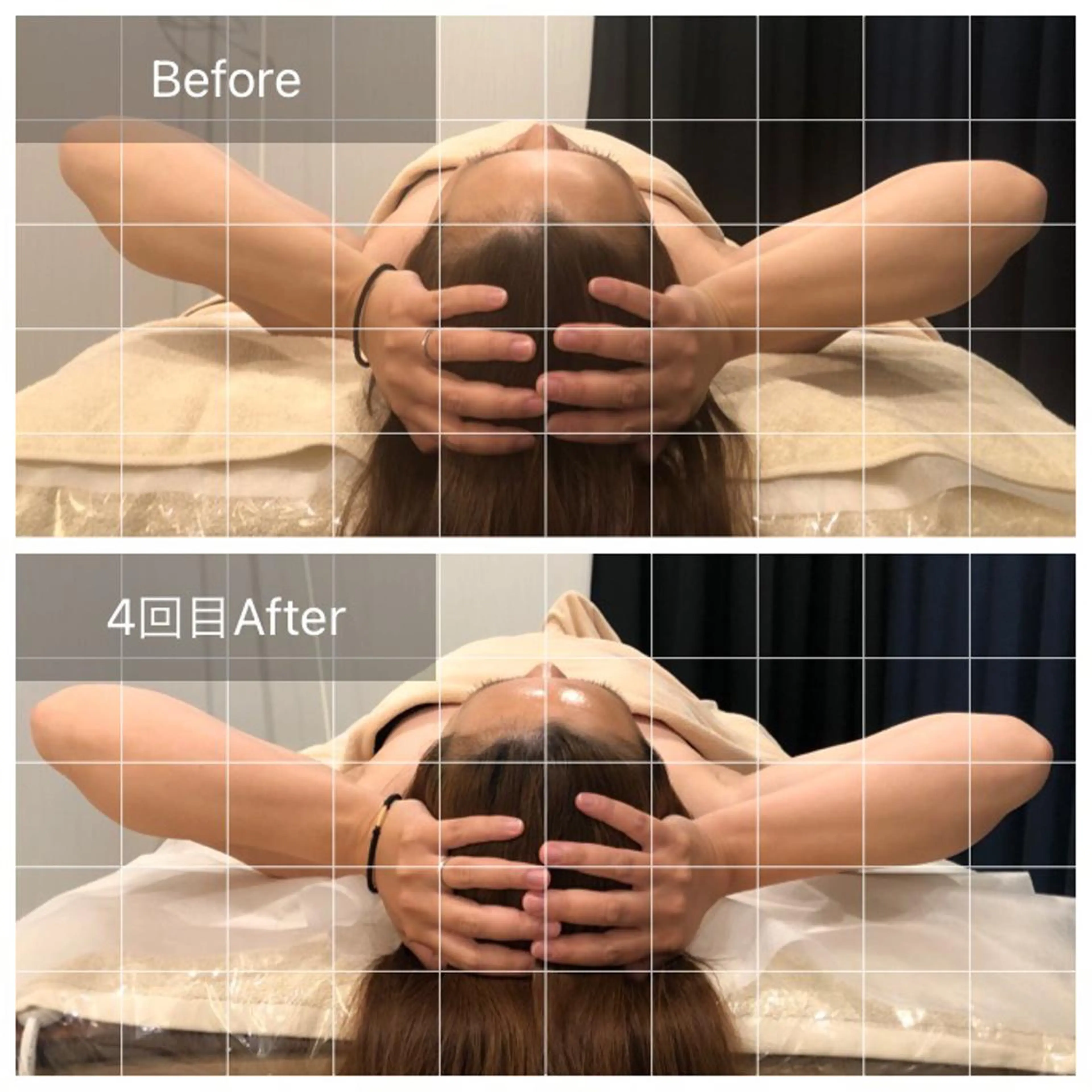 【脳洗浄®︎60分ドライコース】頭痛改善/不眠改善にも🙆‍♀️頭の浮腫みをリセットして若々しいお顔に✨の写真