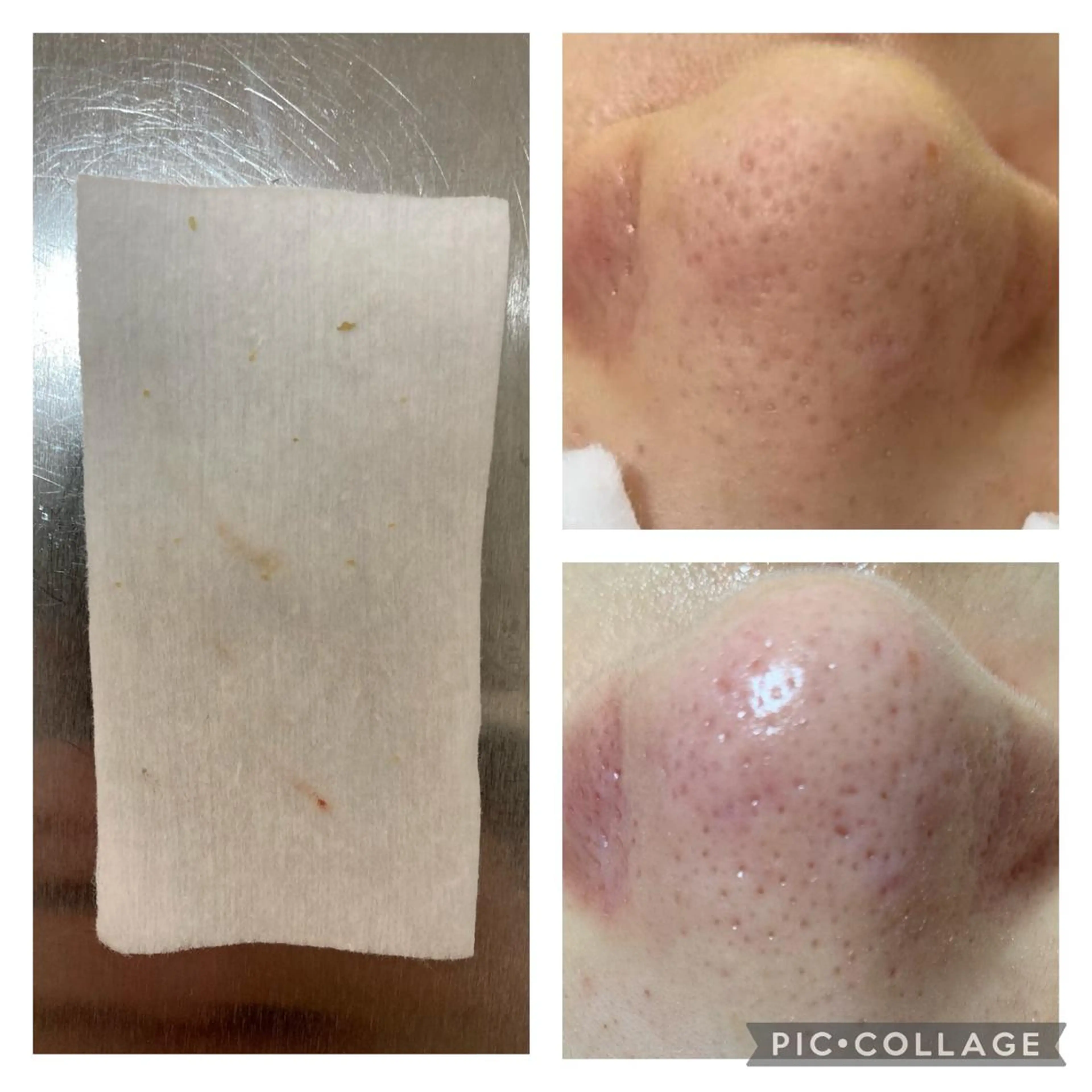 エステ 毛穴ケア・肌質改善 徳川のエステ・リラクイメージ