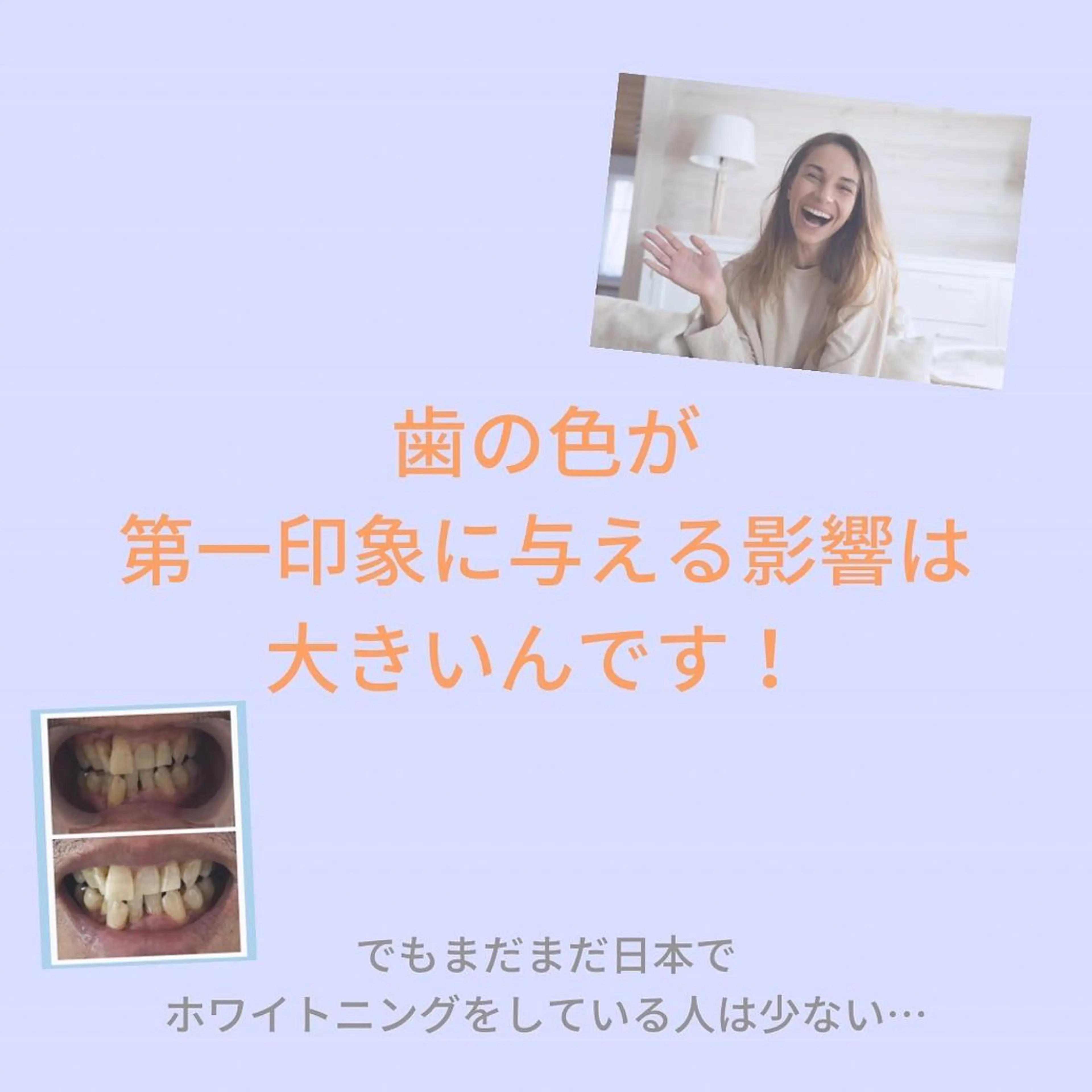 メンズ お手軽ホワイトニングsalon mina所属・武元 奈津美のその他イメージ