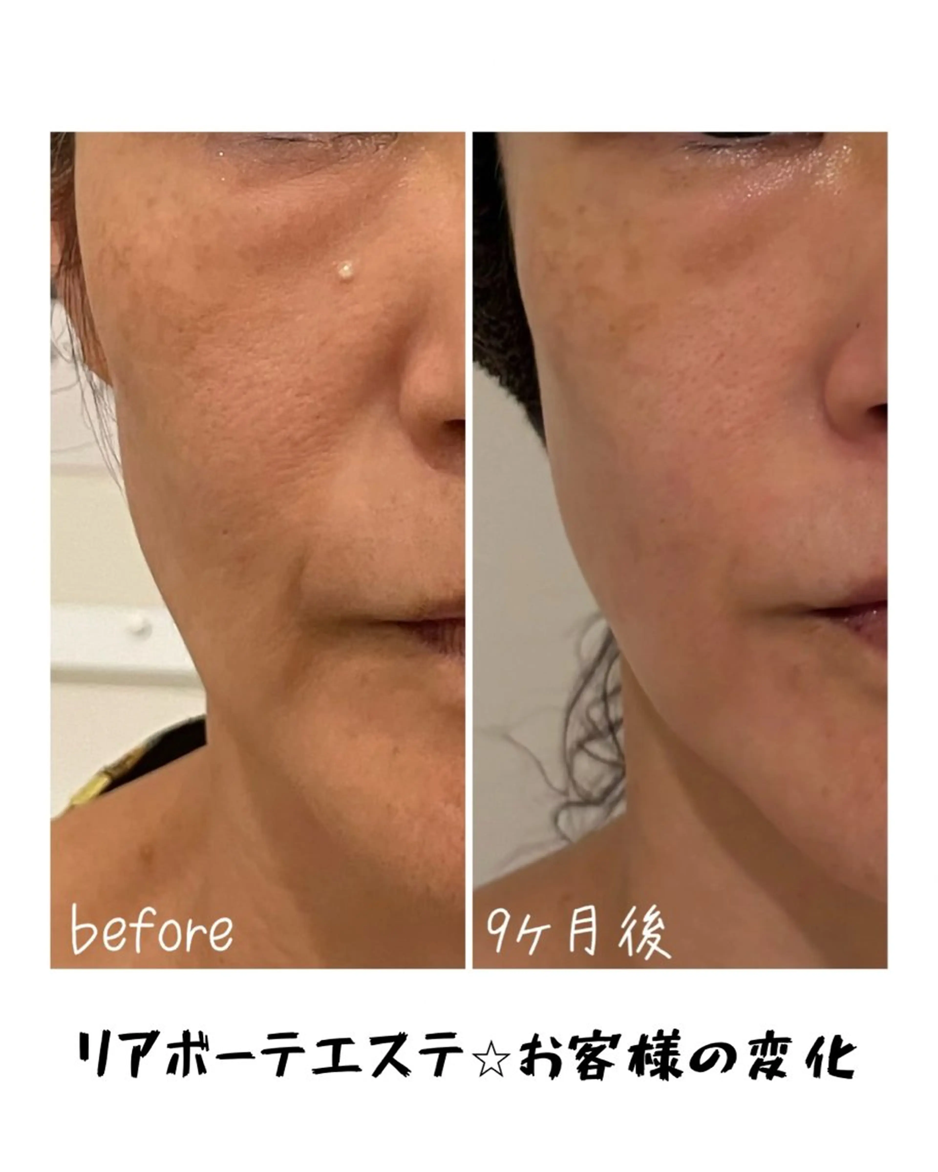 エステ 浜野 恵美のエステ・リラクイメージ