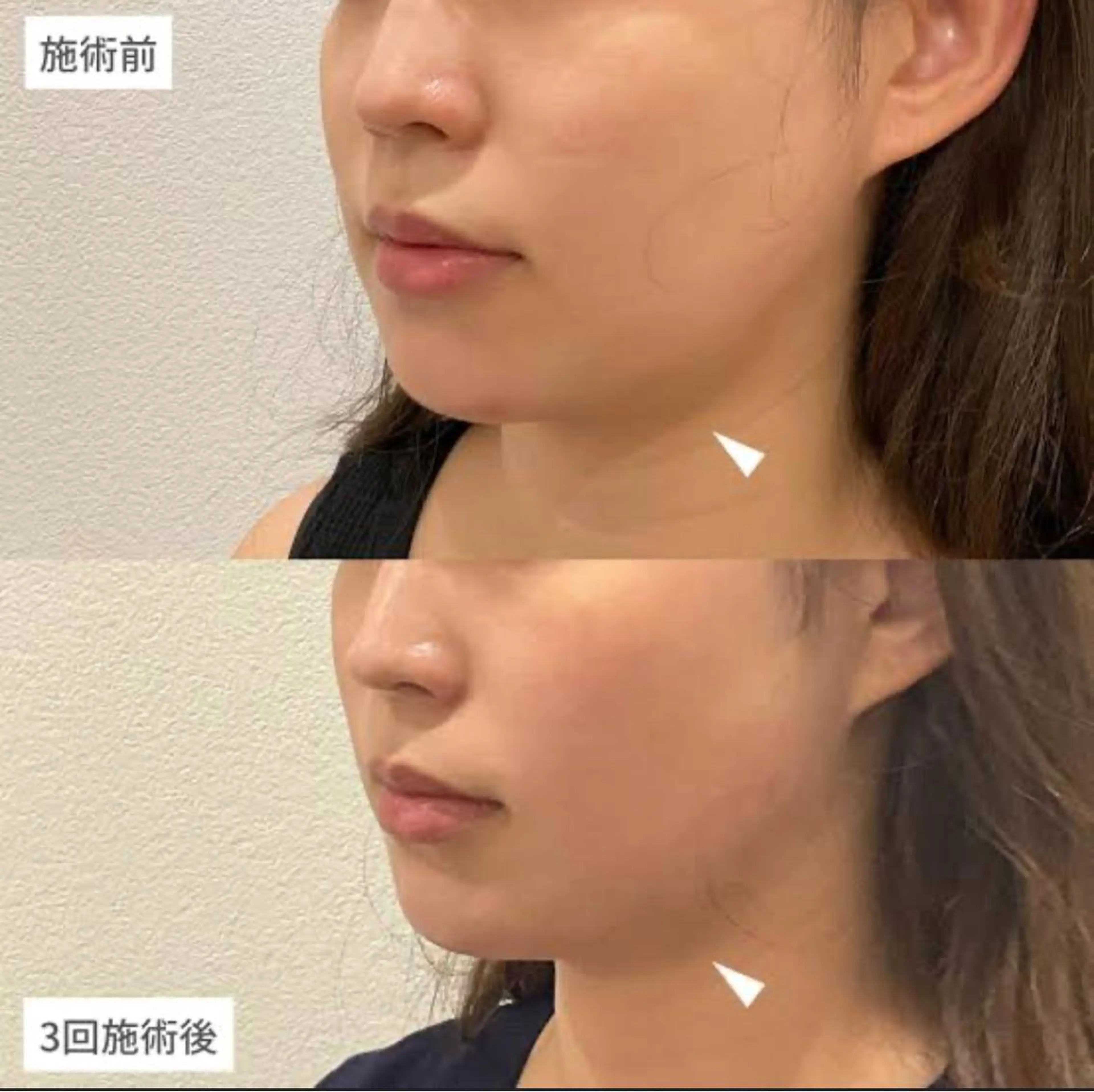 マツエク専門 Angenbelleのマツエク・マツパデザイン