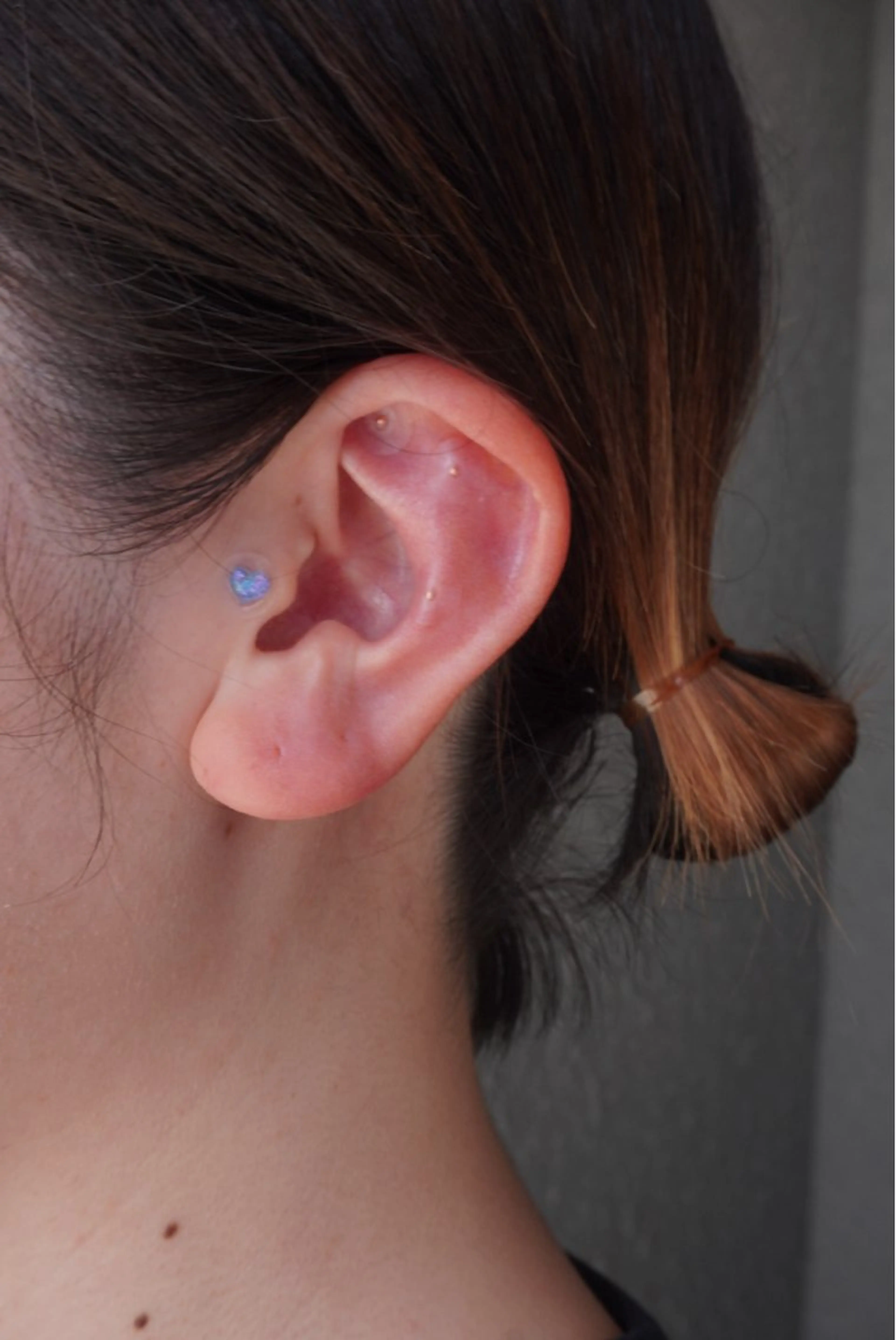 目立たないクリア耳ツボの写真