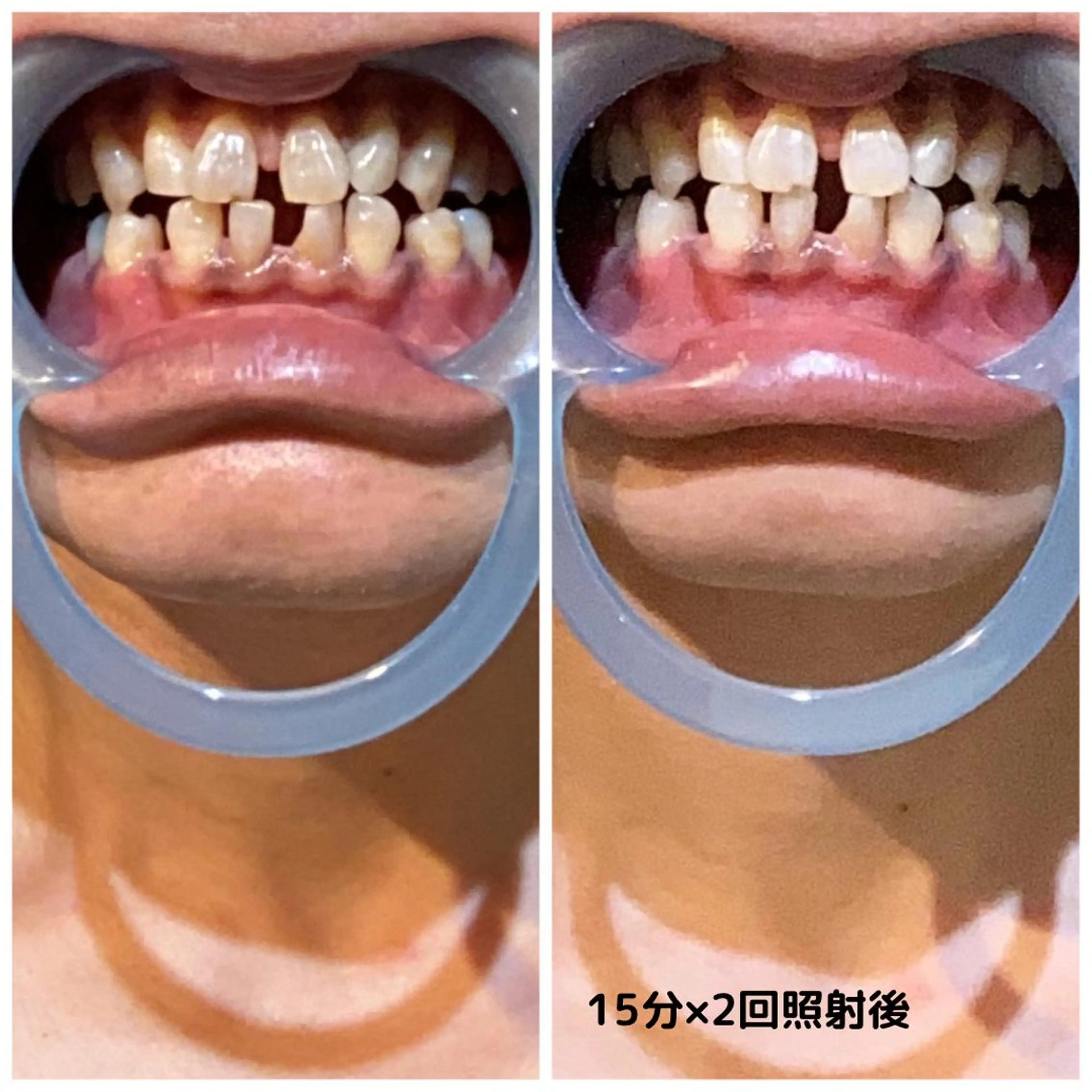 メンズ脱毛ECXIA所属・men's脱毛サロン ECXIAのエステ・リラクイメージ