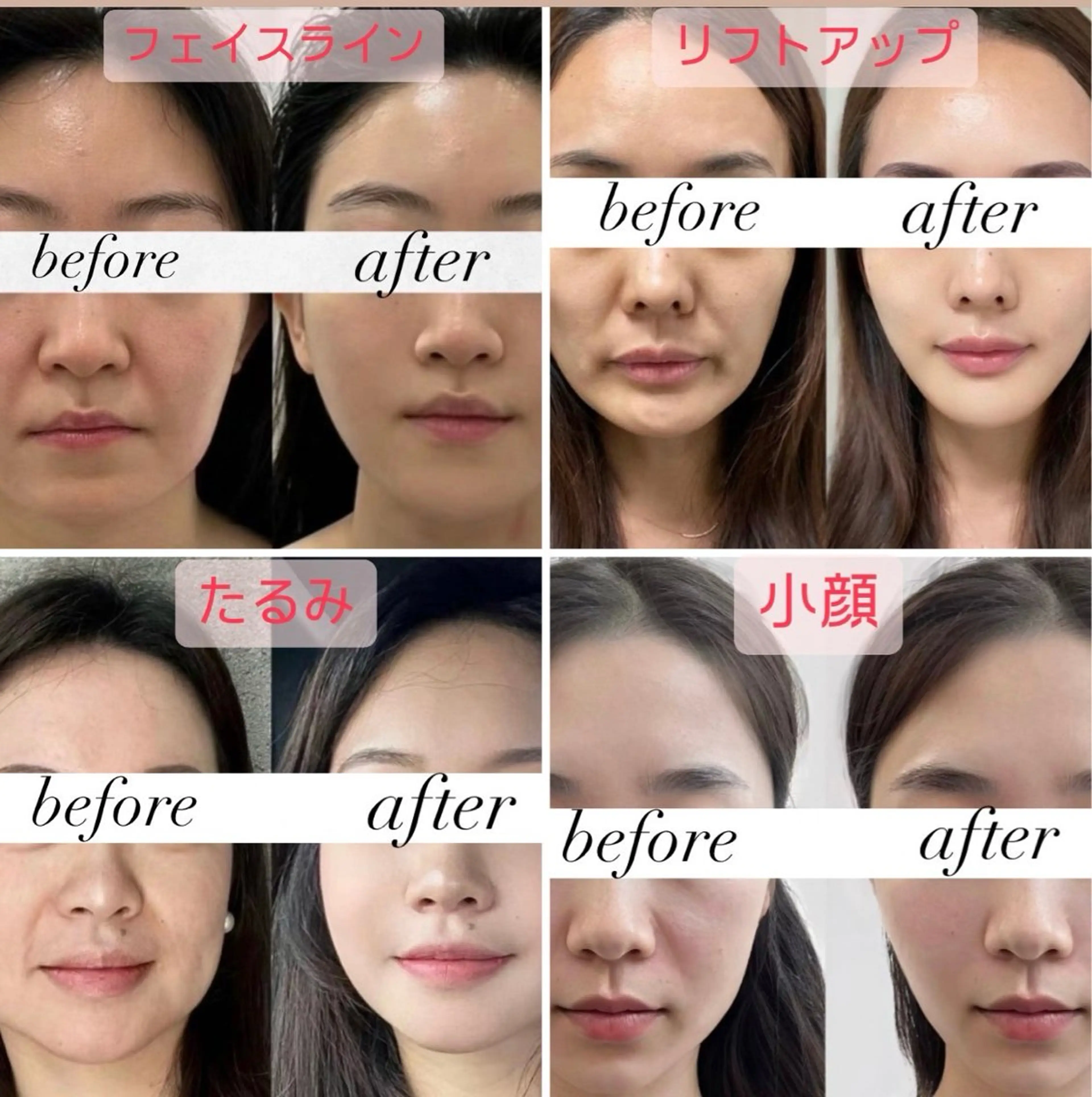 マツエク・マツパ エステ aliaハイフ&水光ジェットサロン所属・aliaハーブ水光店 エステティシャン募集のエステ・リラクイメージ