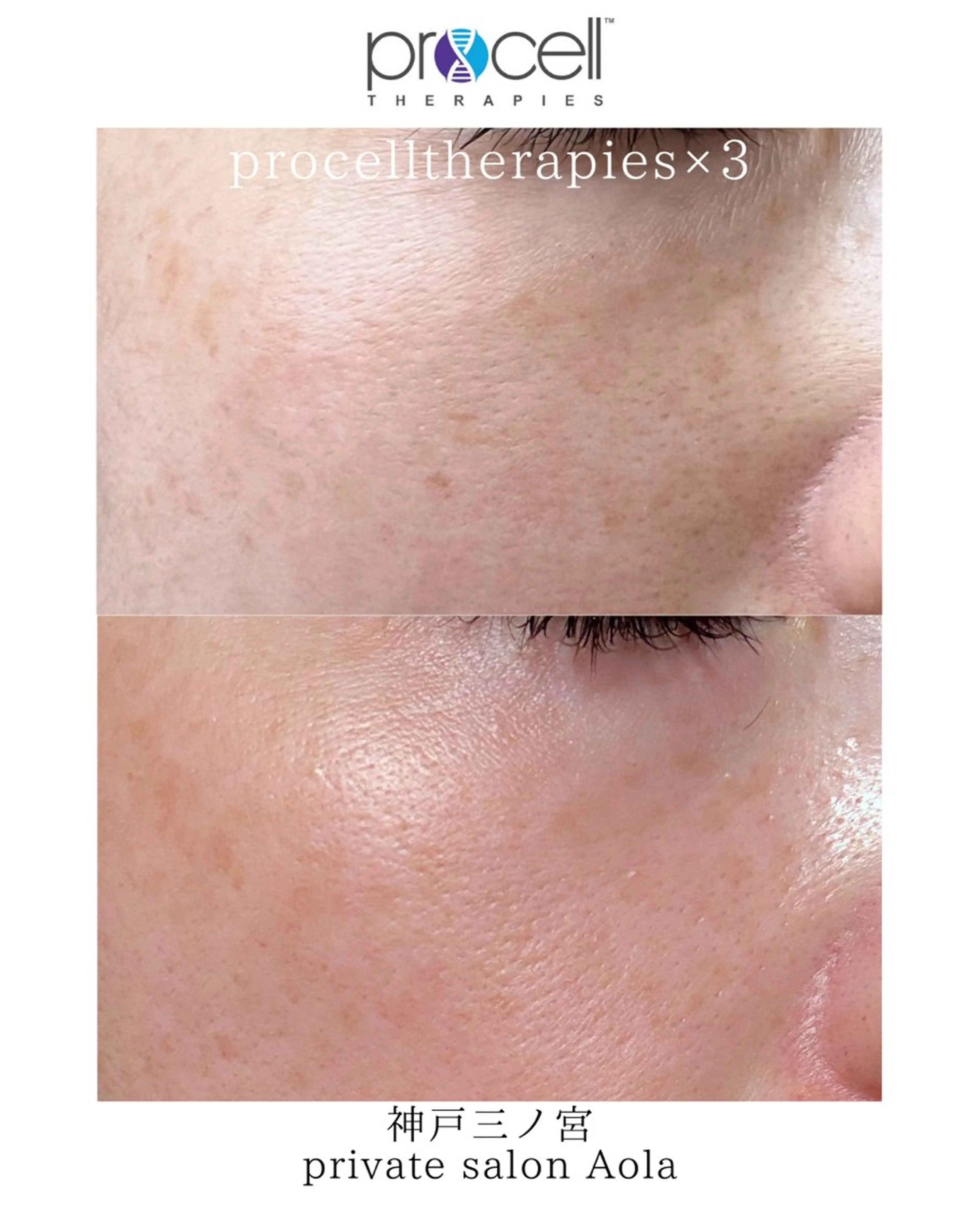 private salon Aola所属・プライベートサロン アオラのネイルデザイン