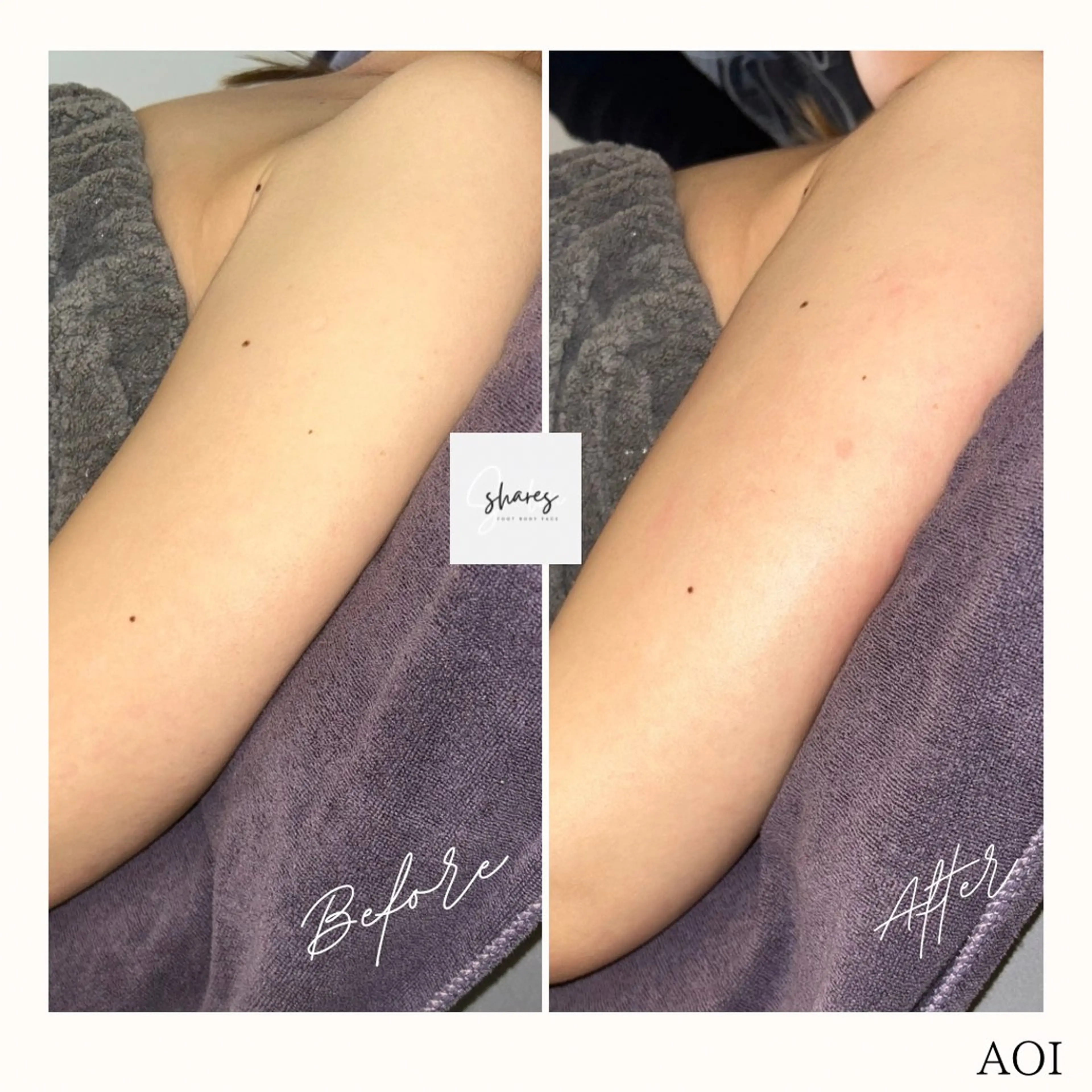 salon shares 辻堂店所属・SHARES AOIのエステ・リラクイメージ