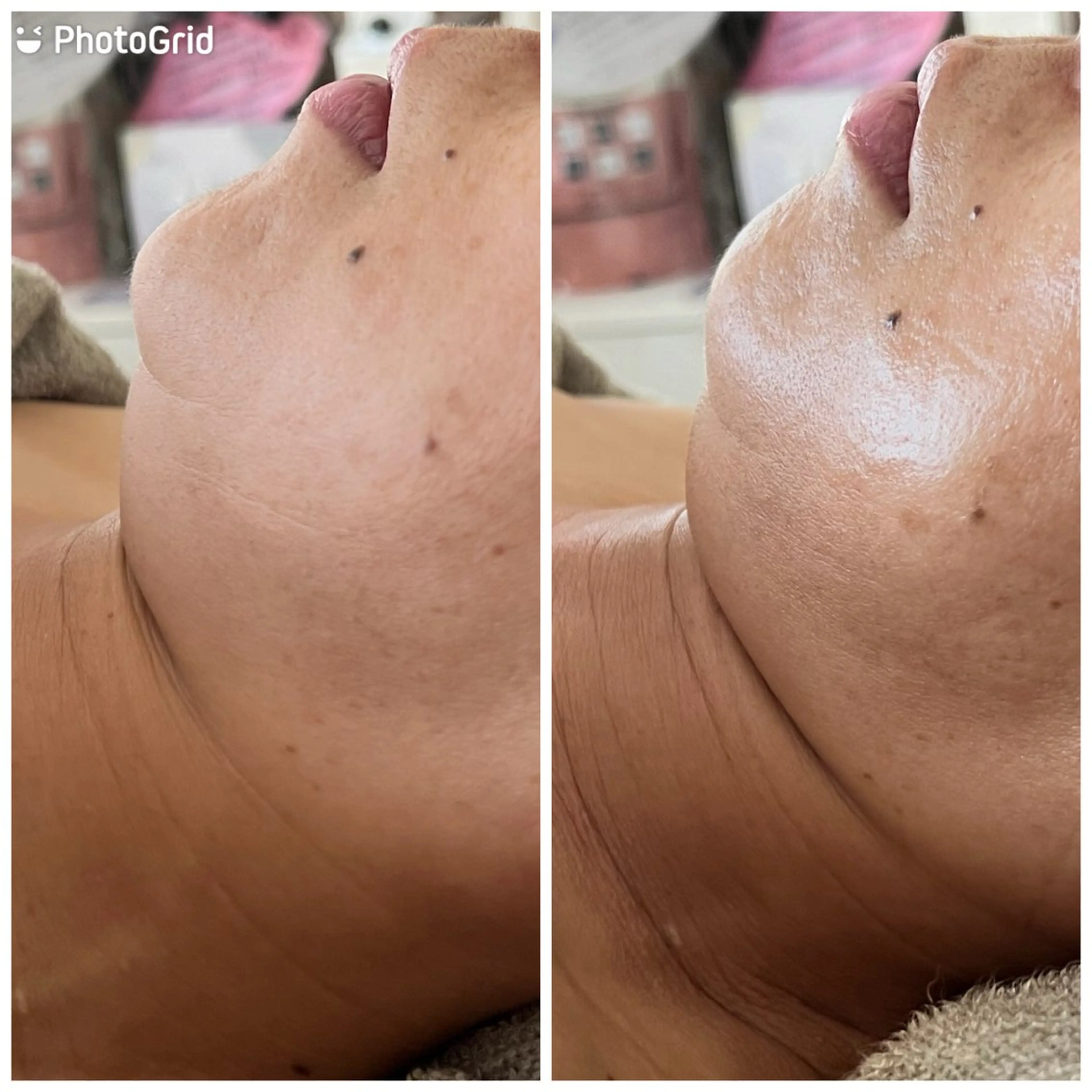 エステ エイジングケア専門 Ponolaのエステ・リラクイメージ