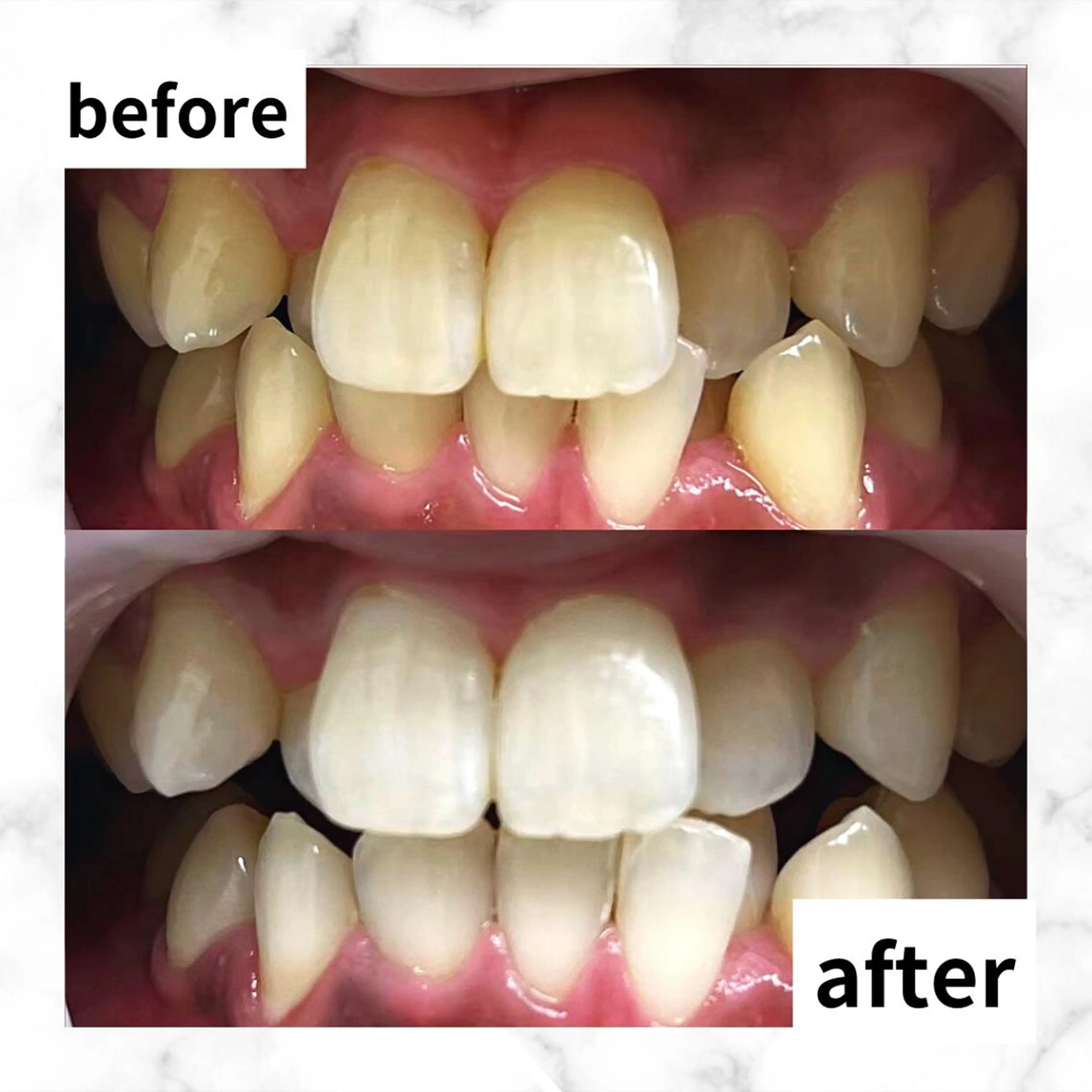 エステ リラク LBSホワイトニング 🌐渋谷店 河内のエステ・リラクイメージ