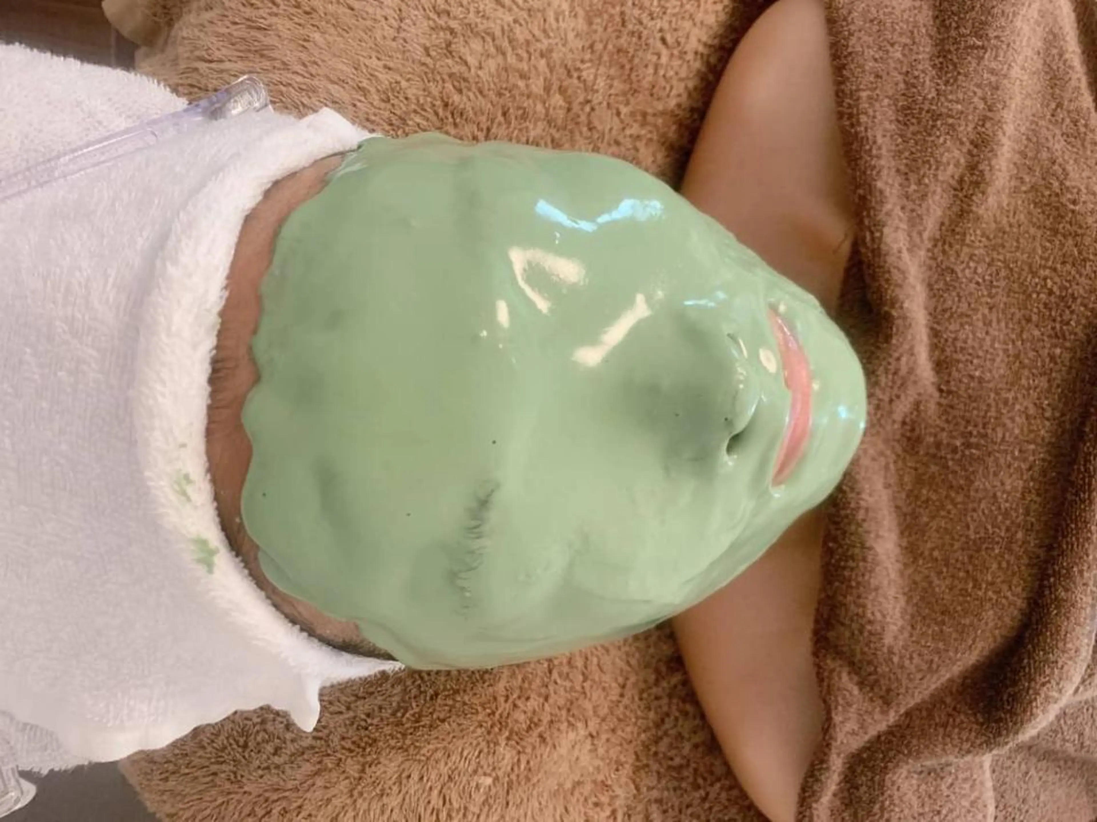 ニキビがお悩みのお客様に!1回で必ず変化を実感🌿ハーブピーリングで古い角質を落とし、肌荒れニキビを防ぐビューネパック!の写真